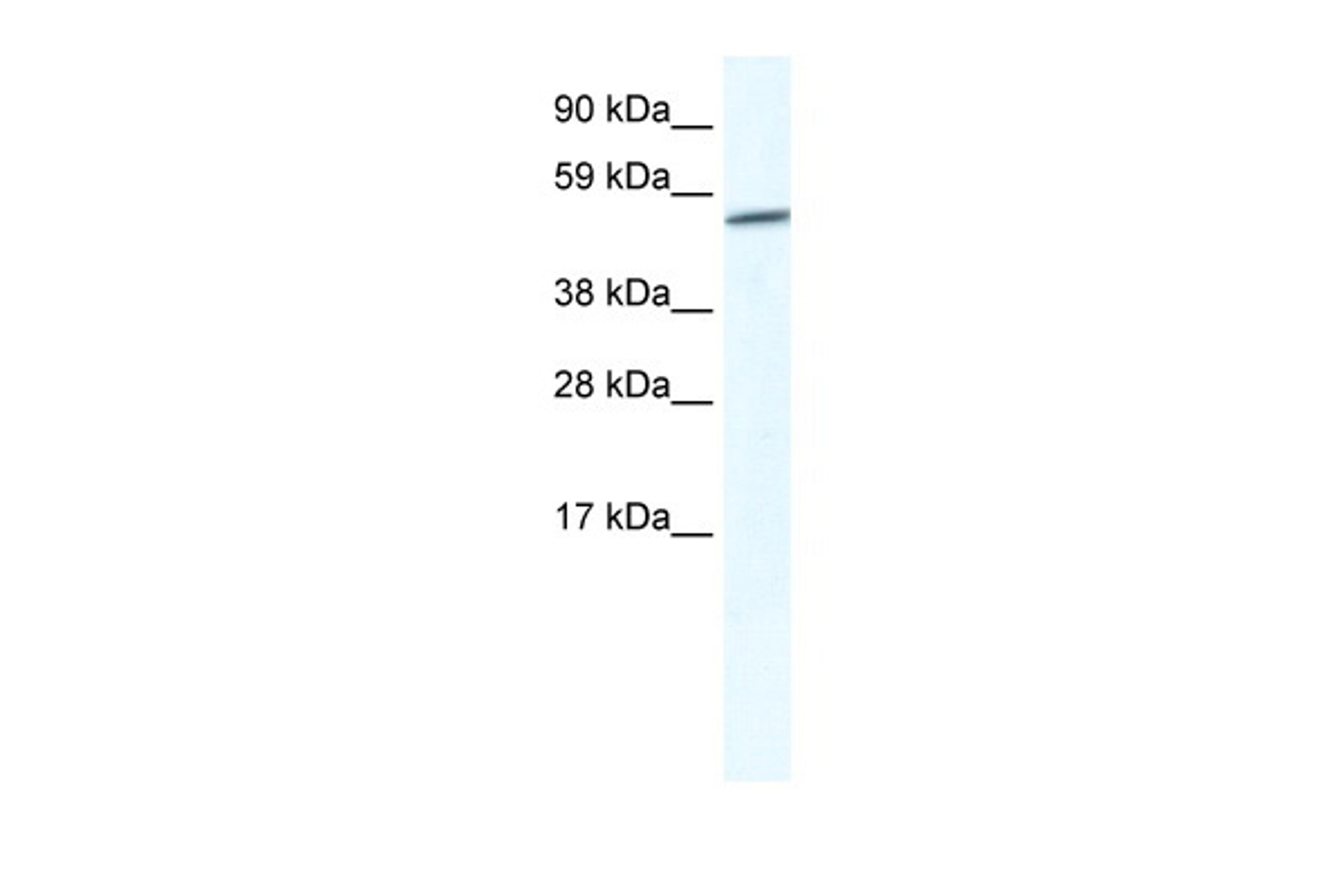 Antibody used in WB on Human Placenta at 2.5 ug/ml.