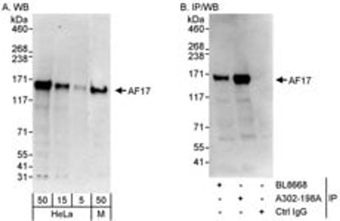 Detection of human and mouse AF17 by western blot (h&m) and immunoprecipitation (h).