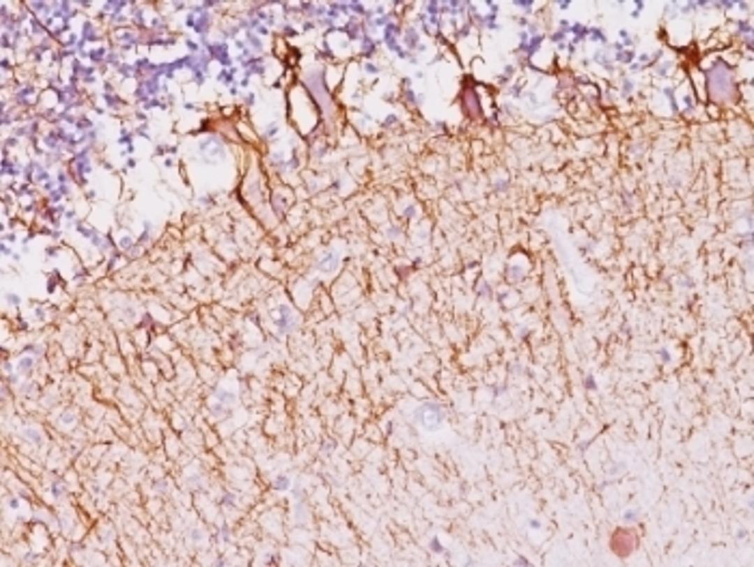 Formalin-fixed, paraffin-embedded human cerebellum stained with Neurofilament antibody (SPM145).