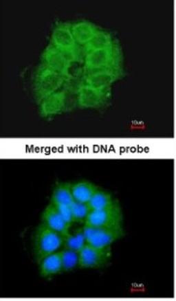 Immunocytochemistry/Immunofluorescence: COX7B2 Antibody [NBP1-33386] - Paraformaldehyde-fixed A431, using antibody at 1:200 dilution.