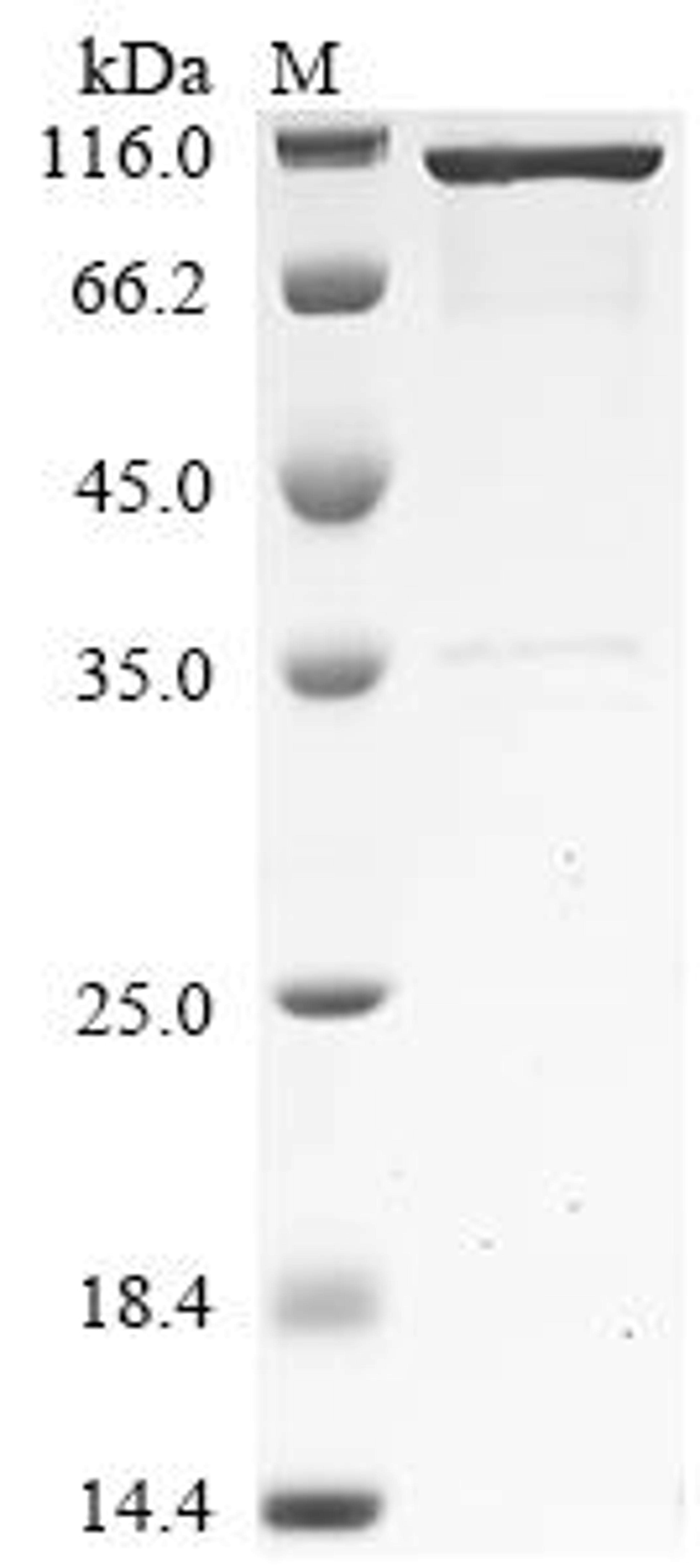 (Tris-Glycine gel) Discontinuous SDS-PAGE (reduced) with 5% enrichment gel and 15% separation gel.