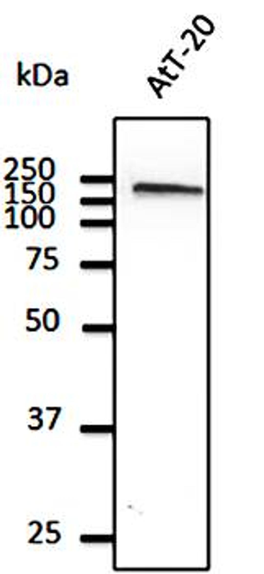 Western blot analysis of AtT-20 cell lysate using EEA1 antibody