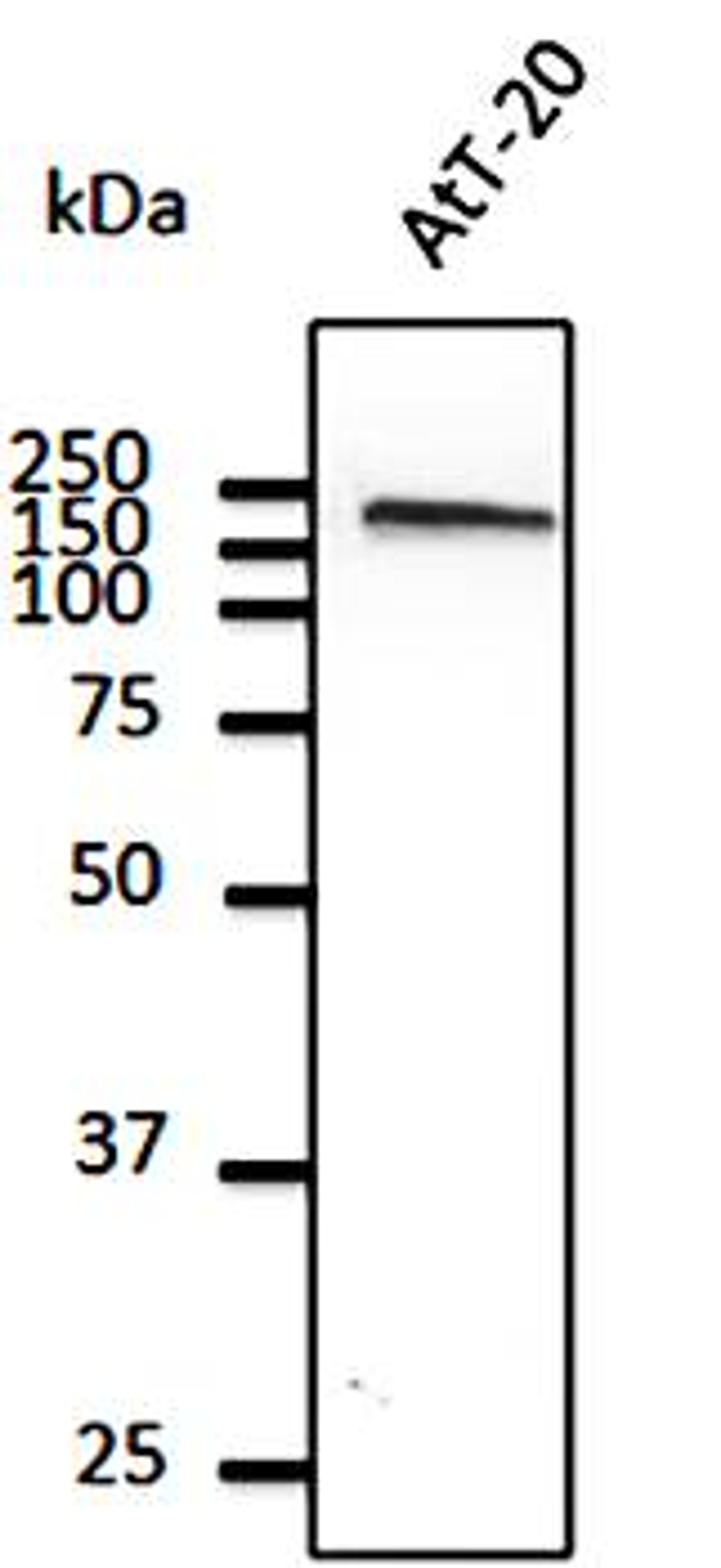 Western blot analysis of AtT-20 cell lysate using EEA1 antibody