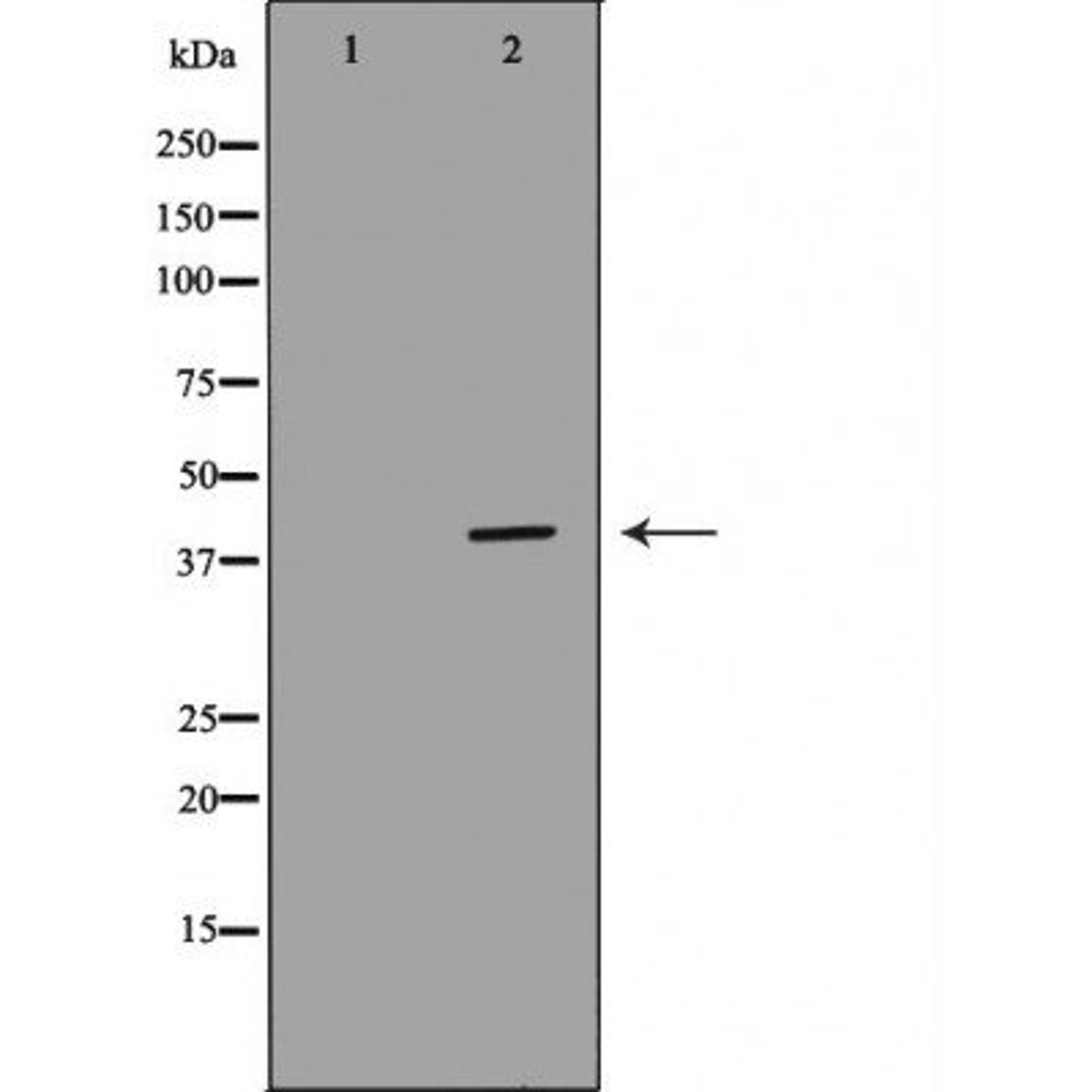 Western blot analysis of mouse kidney cell lines using WNT7A antibody