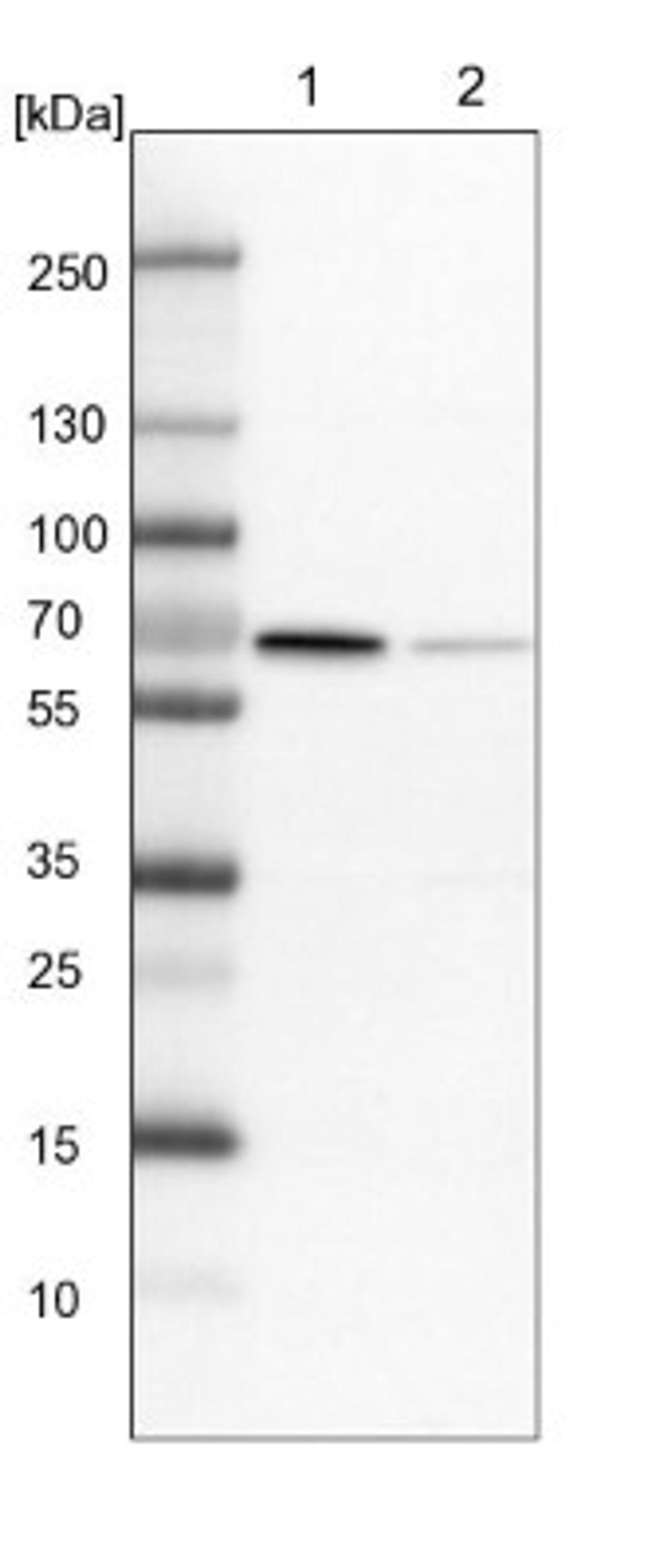 Western Blot: RAI16 Antibody [NBP1-92313] - Lane 1: NIH-3T3 cell lysate (Mouse embryonic fibroblast cells)<br/>Lane 2: NBT-II cell lysate (Rat Wistar bladder tumour cells)