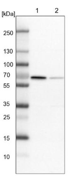 Western Blot: RAI16 Antibody [NBP1-92313] - Lane 1: NIH-3T3 cell lysate (Mouse embryonic fibroblast cells)<br/>Lane 2: NBT-II cell lysate (Rat Wistar bladder tumour cells)