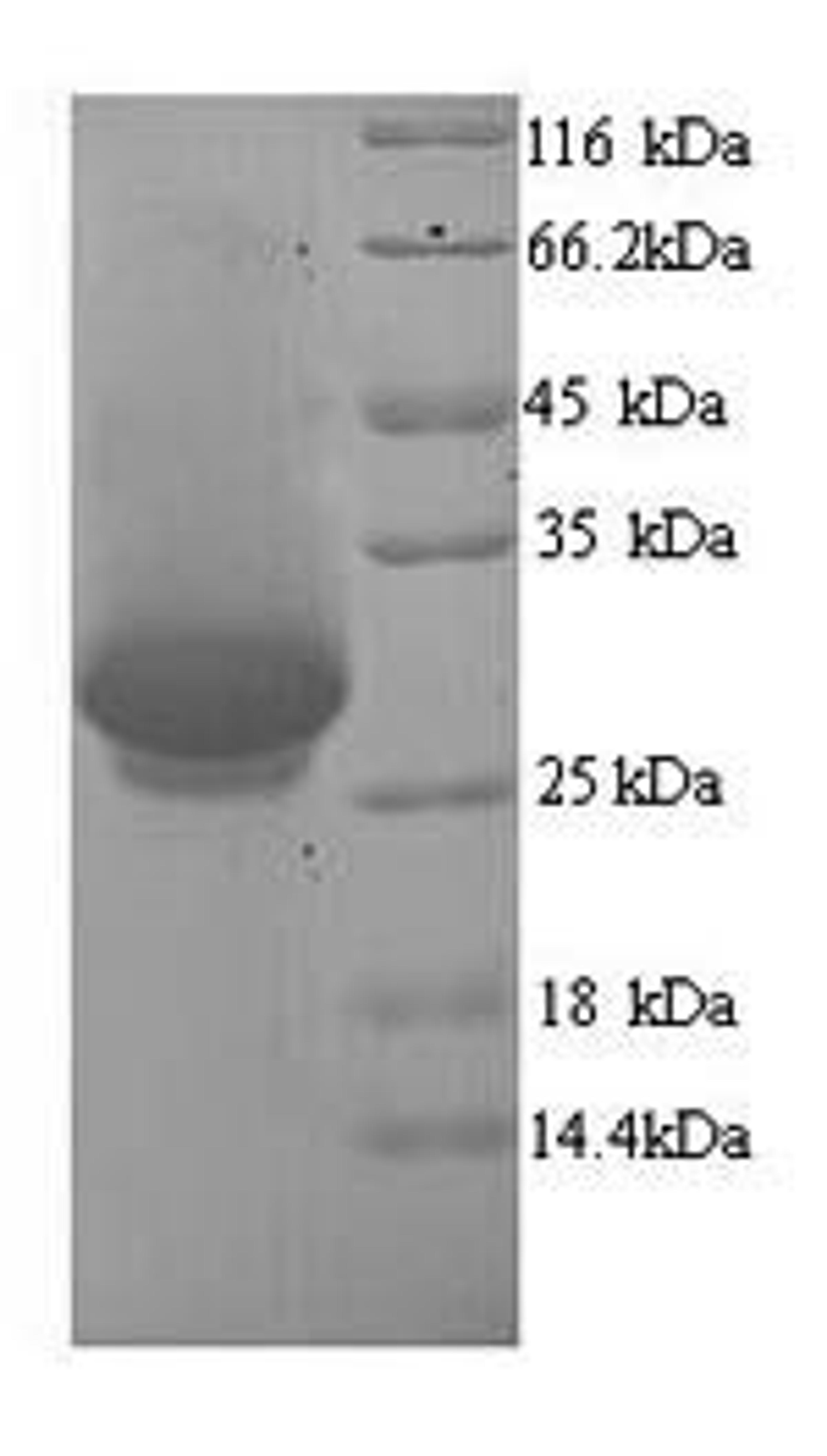 (Tris-Glycine gel) Discontinuous SDS-PAGE (reduced) with 5% enrichment gel and 15% separation gel.