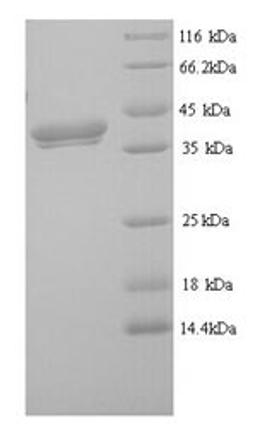 (Tris-Glycine gel) Discontinuous SDS-PAGE (reduced) with 5% enrichment gel and 15% separation gel.