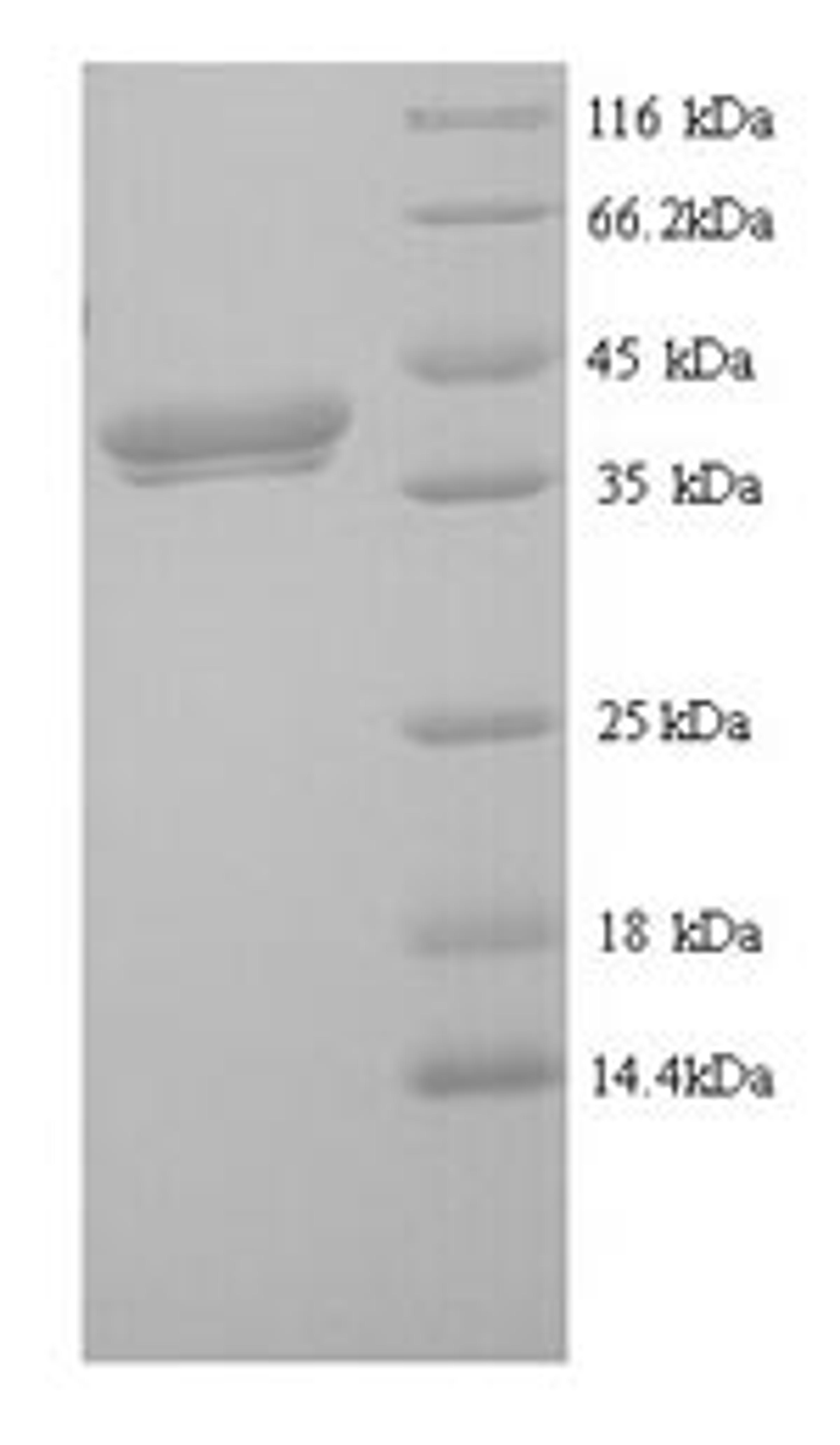 (Tris-Glycine gel) Discontinuous SDS-PAGE (reduced) with 5% enrichment gel and 15% separation gel.