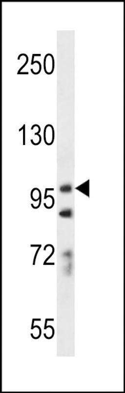 Western blot analysis in A549 cell line lysates (35ug/lane).