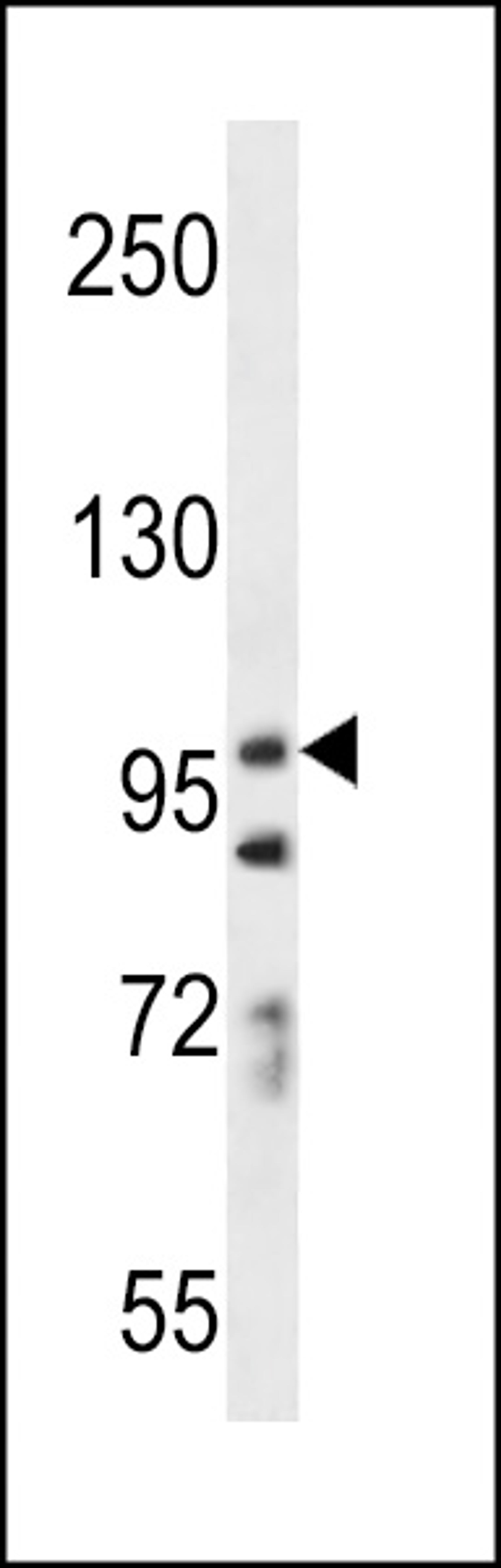 Western blot analysis in A549 cell line lysates (35ug/lane).