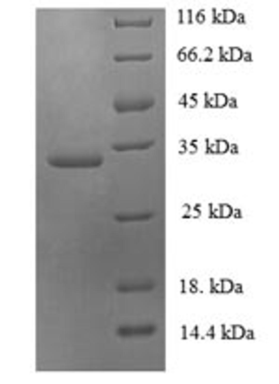 (Tris-Glycine gel) Discontinuous SDS-PAGE (reduced) with 5% enrichment gel and 15% separation gel.