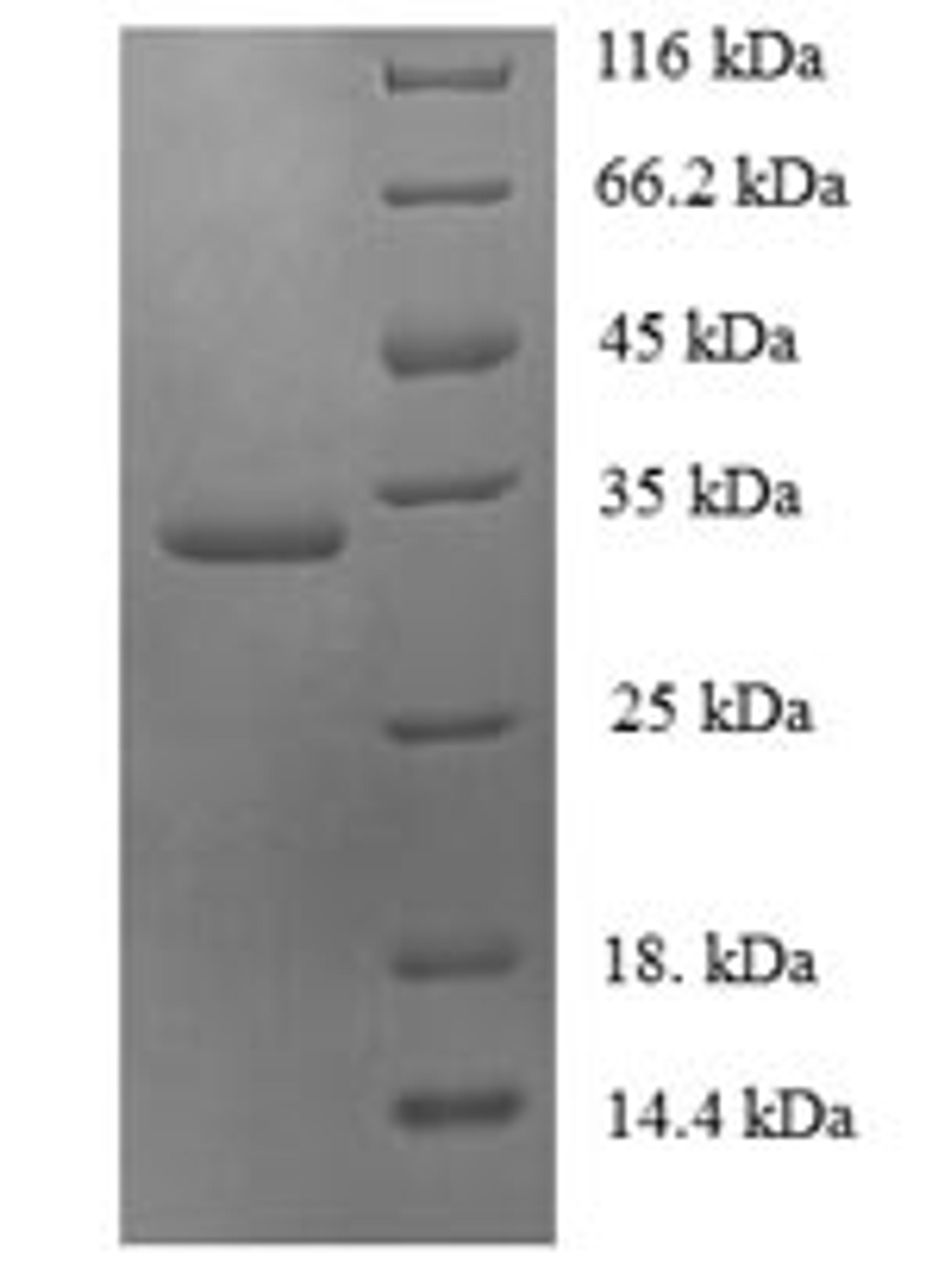 (Tris-Glycine gel) Discontinuous SDS-PAGE (reduced) with 5% enrichment gel and 15% separation gel.