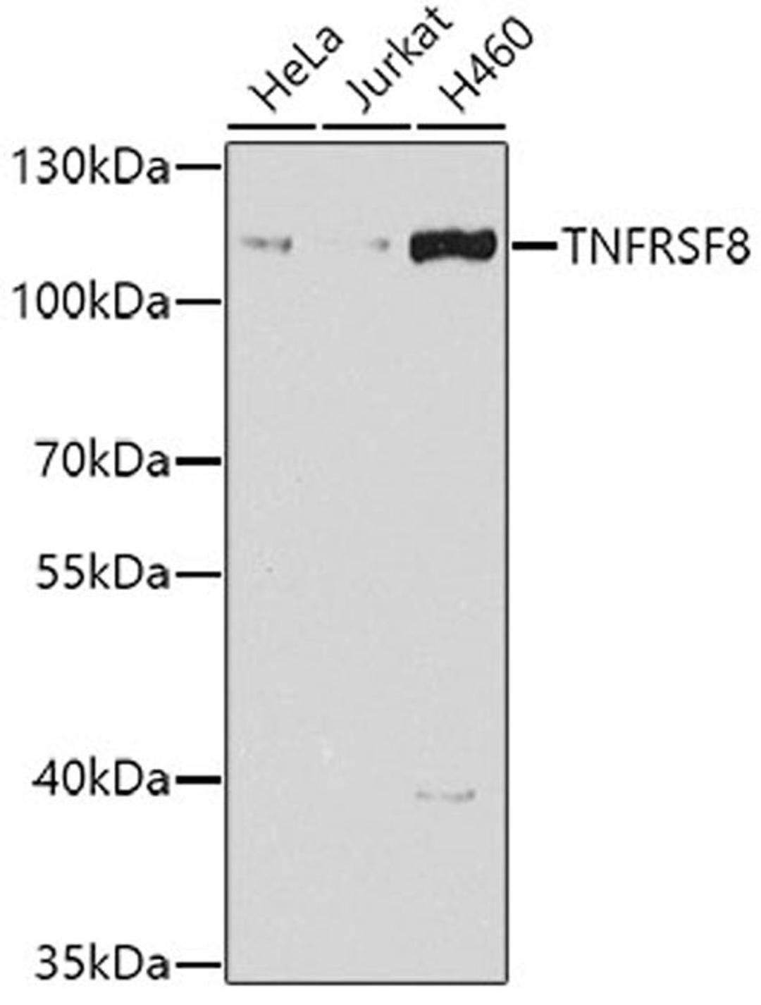 Western blot - TNFRSF8 antibody (A7651)