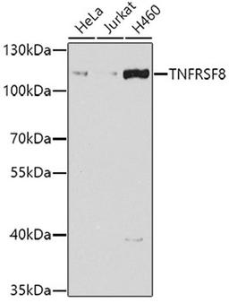 Western blot - TNFRSF8 antibody (A7651)