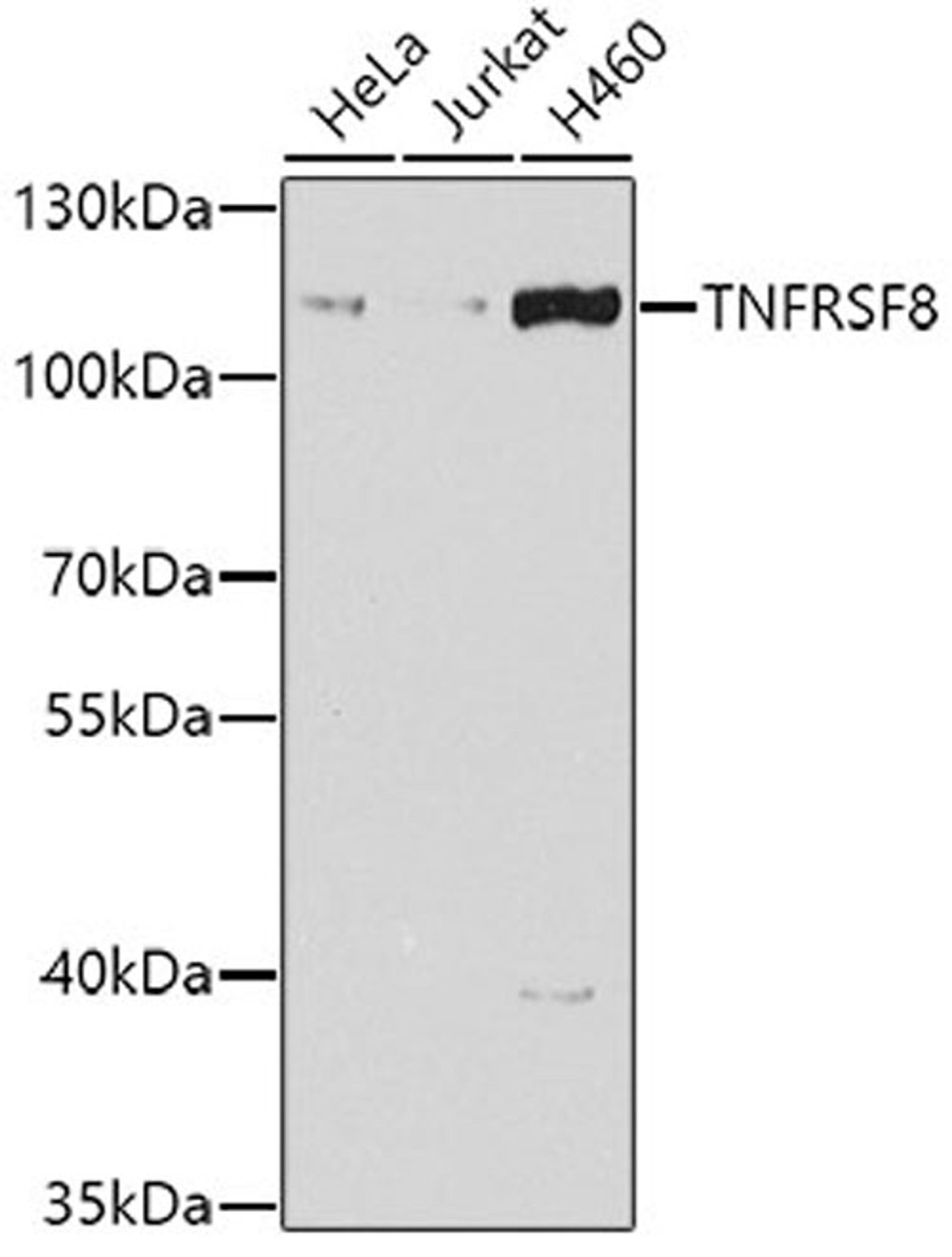 Western blot - TNFRSF8 antibody (A7651)