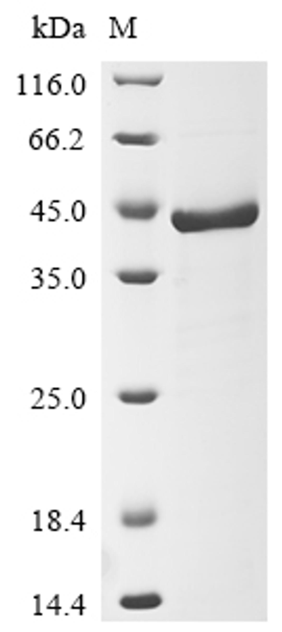 (Tris-Glycine gel) Discontinuous SDS-PAGE (reduced) with 5% enrichment gel and 15% separation gel.
