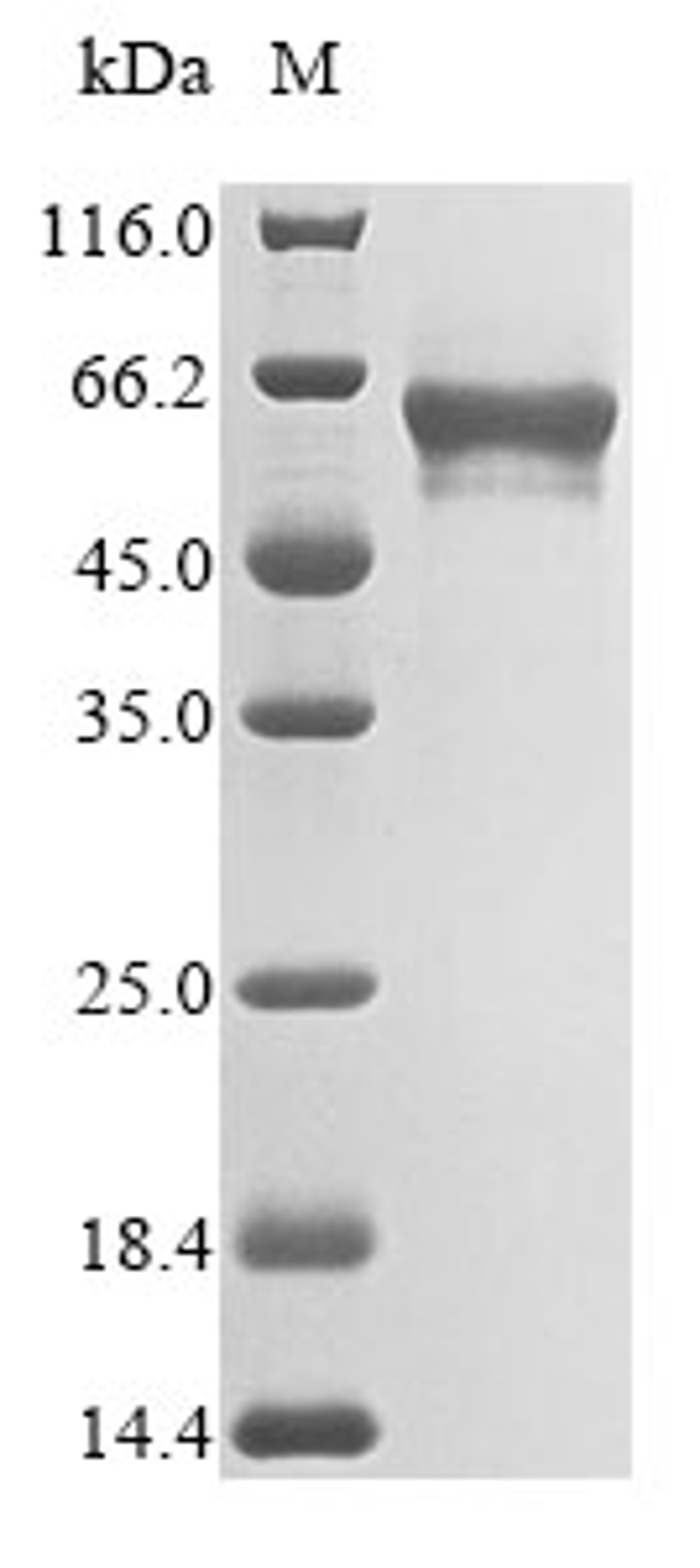 (Tris-Glycine gel) Discontinuous SDS-PAGE (reduced) with 5% enrichment gel and 15% separation gel.