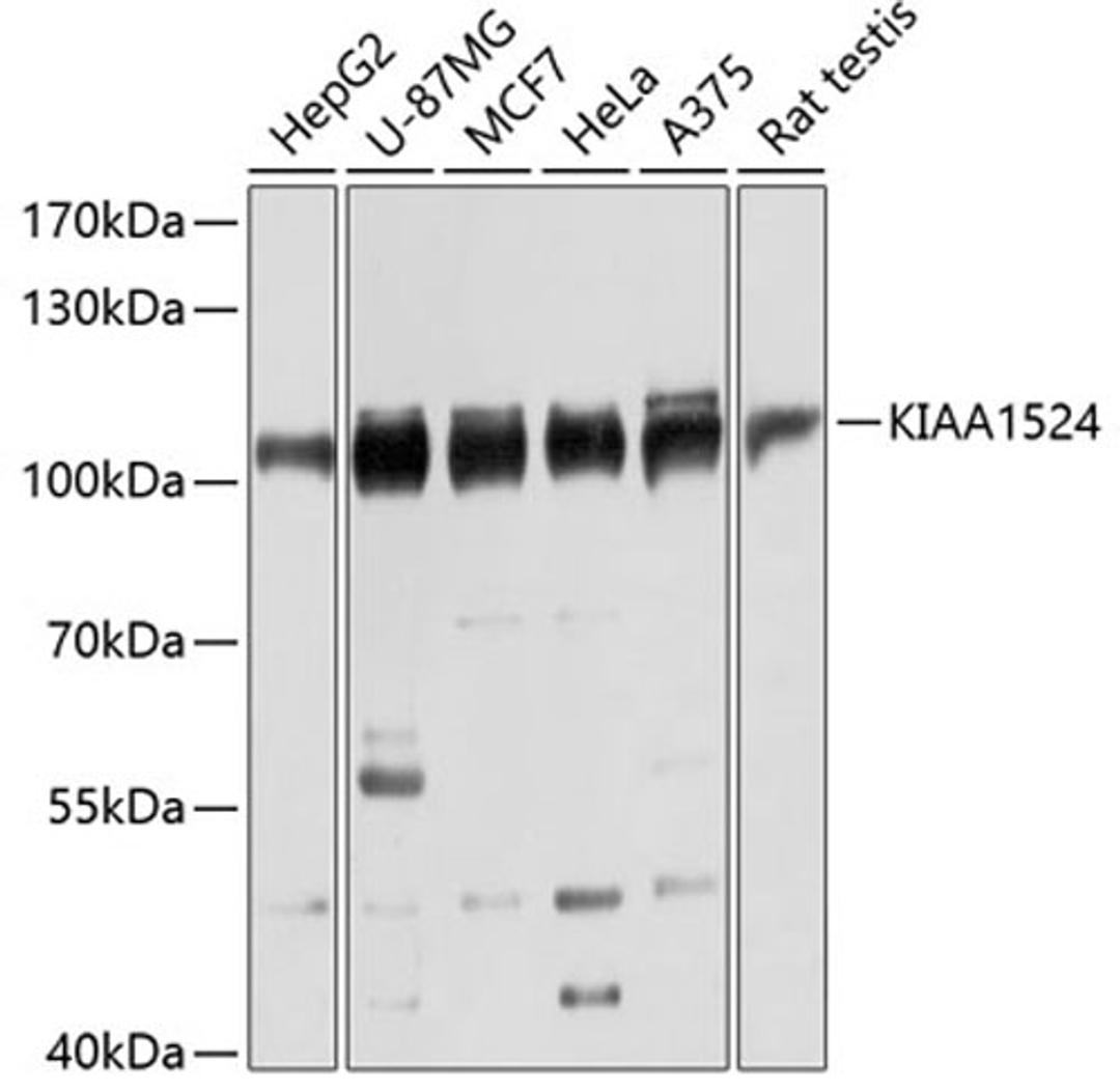 Western blot - KIAA1524 antibody (A12267)