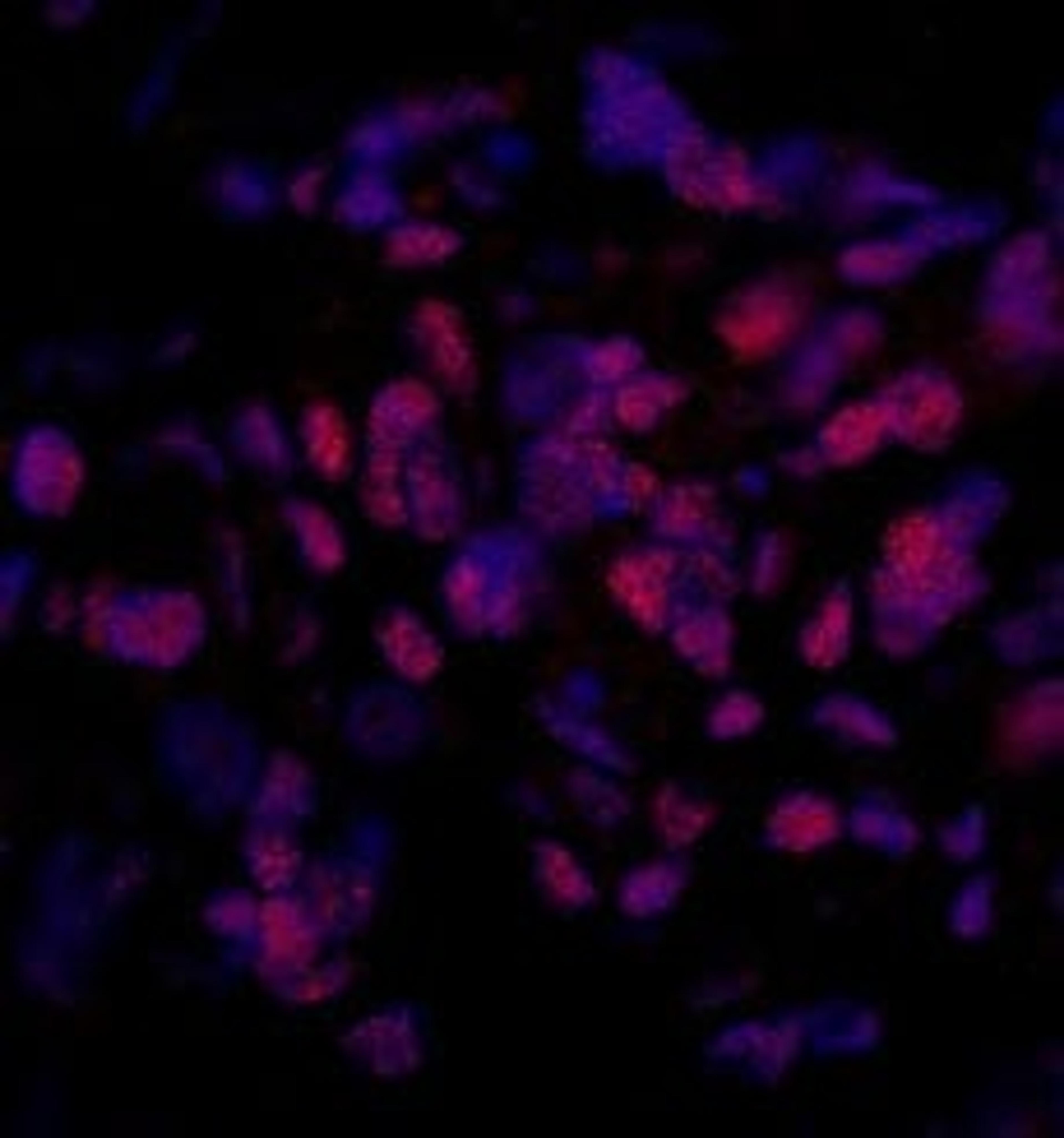 Detection of human PPP4R3 Beta by immunohistochemistry.