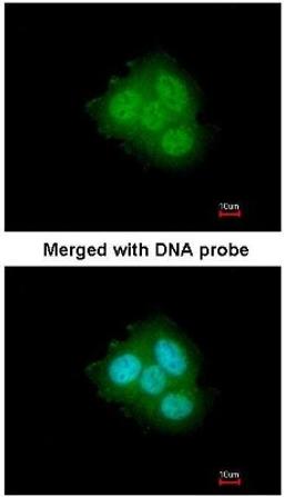 Immunocytochemistry/Immunofluorescence: FKBP4/FKBP52 Antibody [NBP1-33702] - Paraformaldehyde-fixed A431, using FKBP4/FKBP52 (NBP1-33702) antibody at 1:200 dilution.