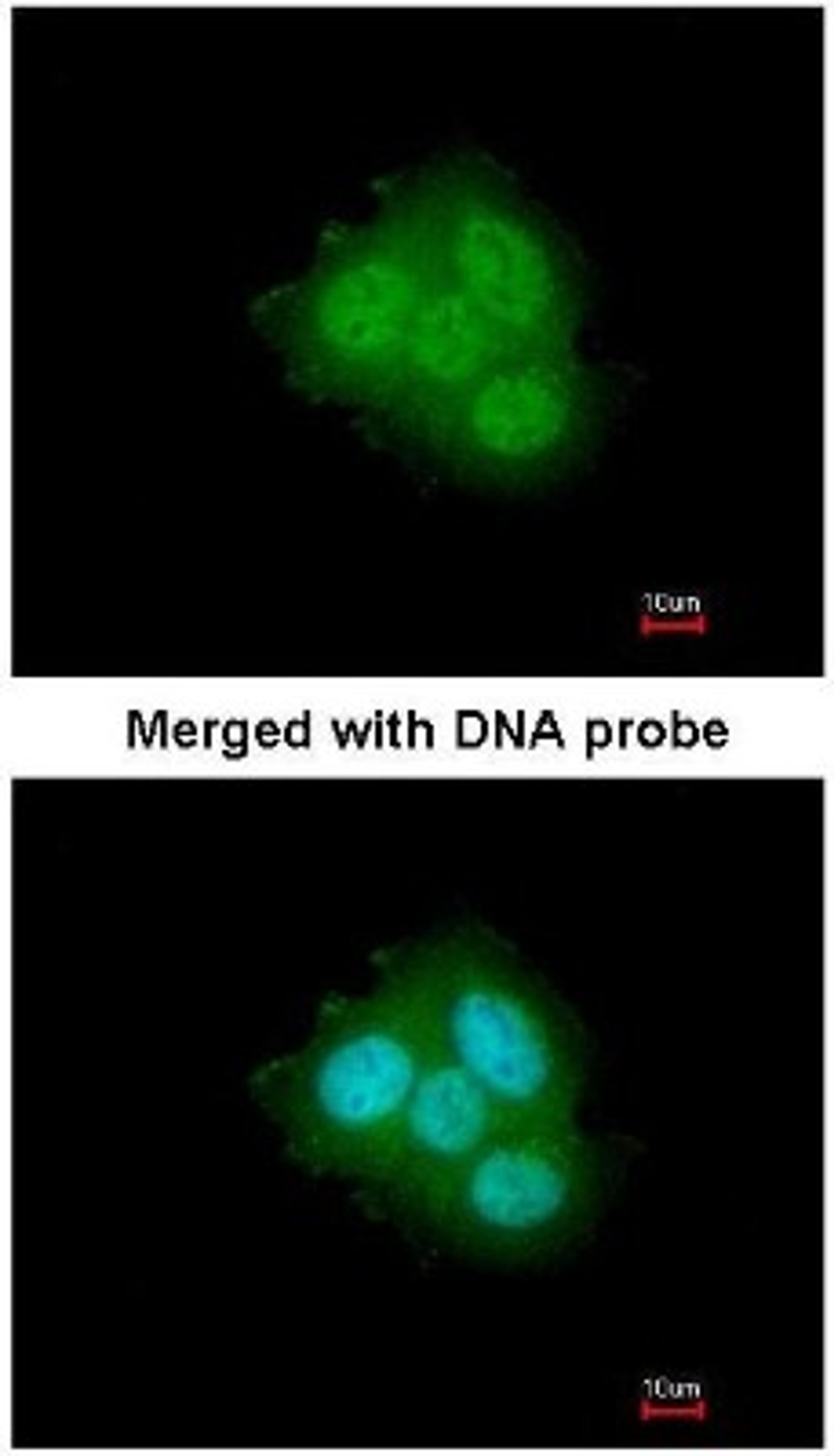 Immunocytochemistry/Immunofluorescence: FKBP4/FKBP52 Antibody [NBP1-33702] - Paraformaldehyde-fixed A431, using FKBP4/FKBP52 (NBP1-33702) antibody at 1:200 dilution.