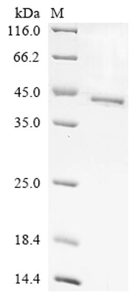 (Tris-Glycine gel) Discontinuous SDS-PAGE (reduced) with 5% enrichment gel and 15% separation gel.
