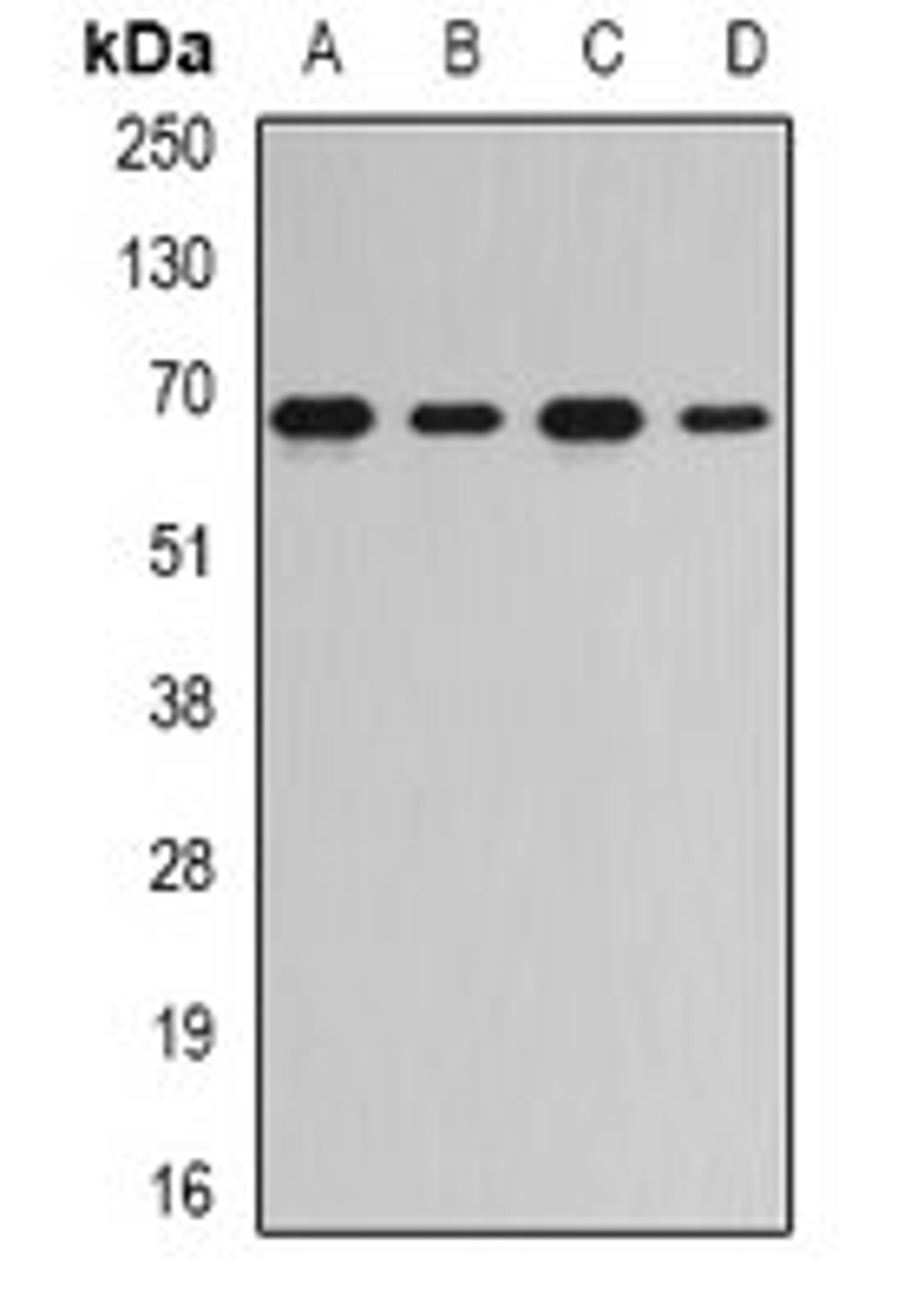 Western blot analysis of Jurkat (Lane1), Hela (Lane2), mouse spleen (Lane3), rat kidney (Lane4) whole cell lysates using RNGTT antibody