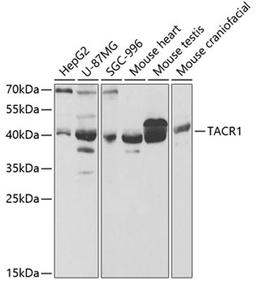 Western blot - TACR1 antibody (A5565)