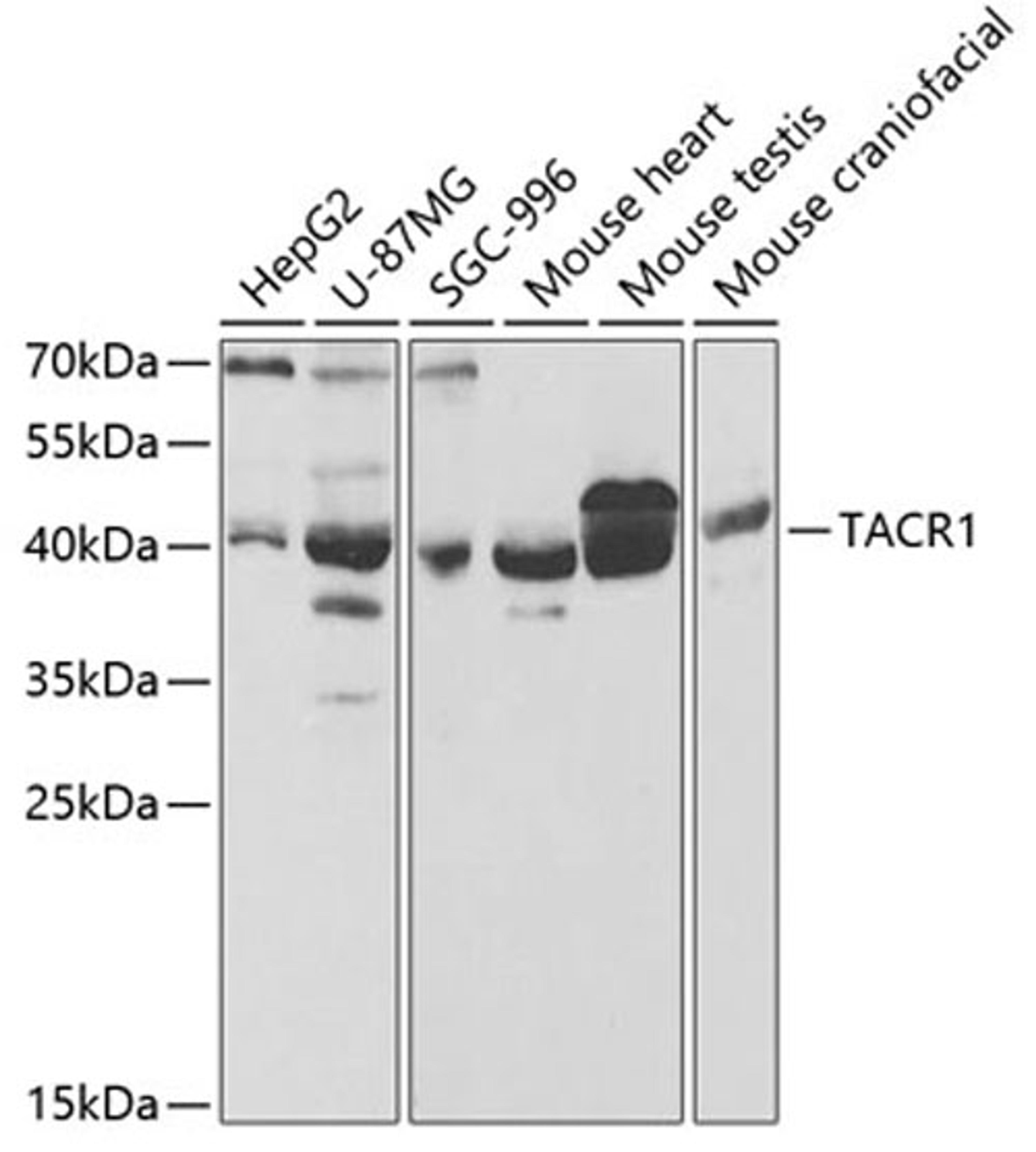 Western blot - TACR1 antibody (A5565)