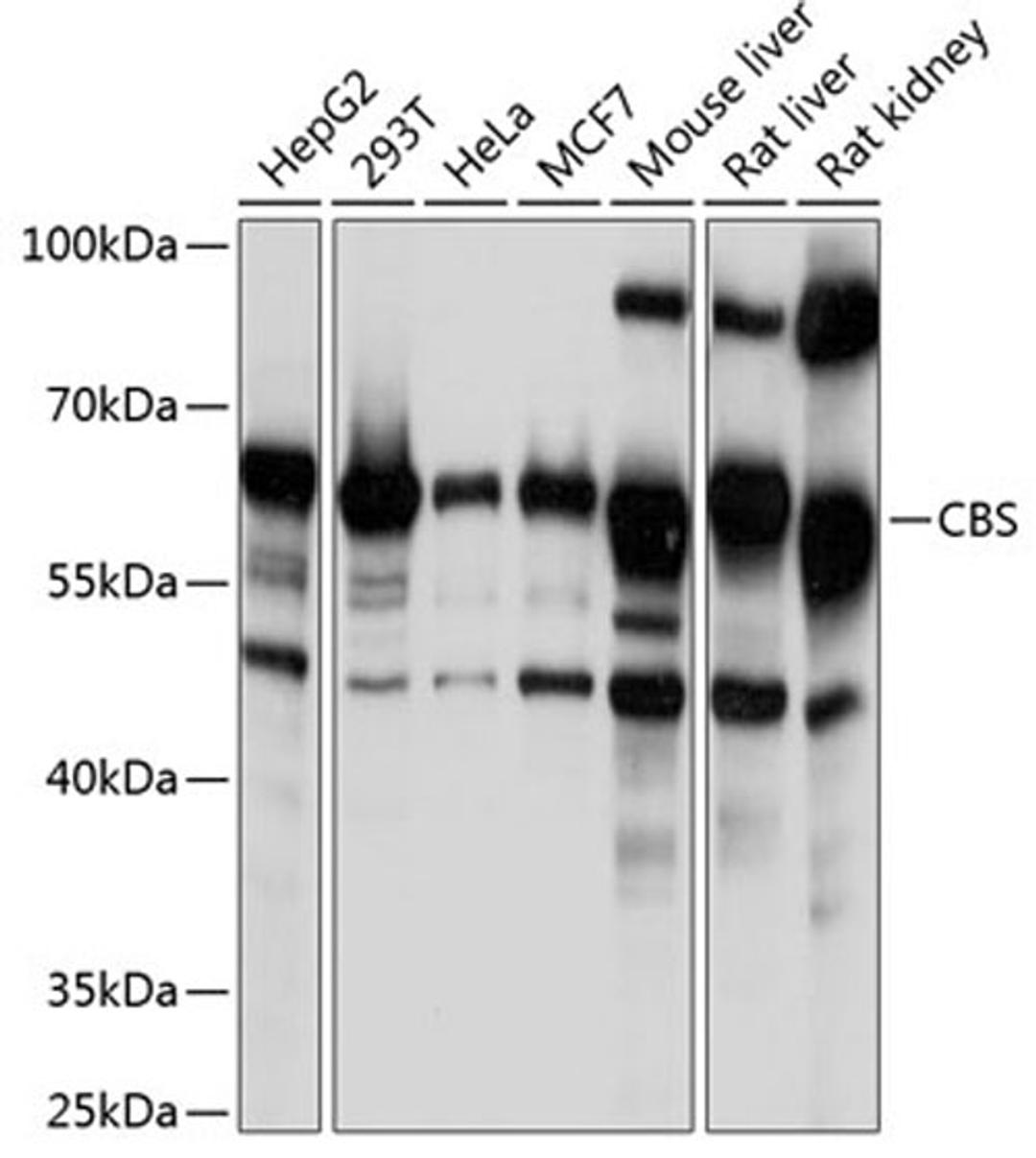 Western blot - CBS Polyclonal Antibody (A1427)