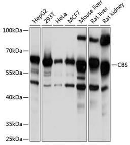 Western blot - CBS Polyclonal Antibody (A1427)