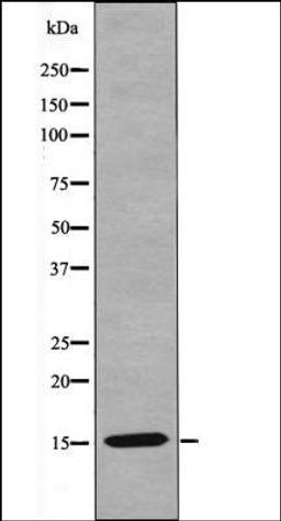 Western blot analysis of HeLa whole cell lysates using VAMP4 -Phospho-Ser30- antibody