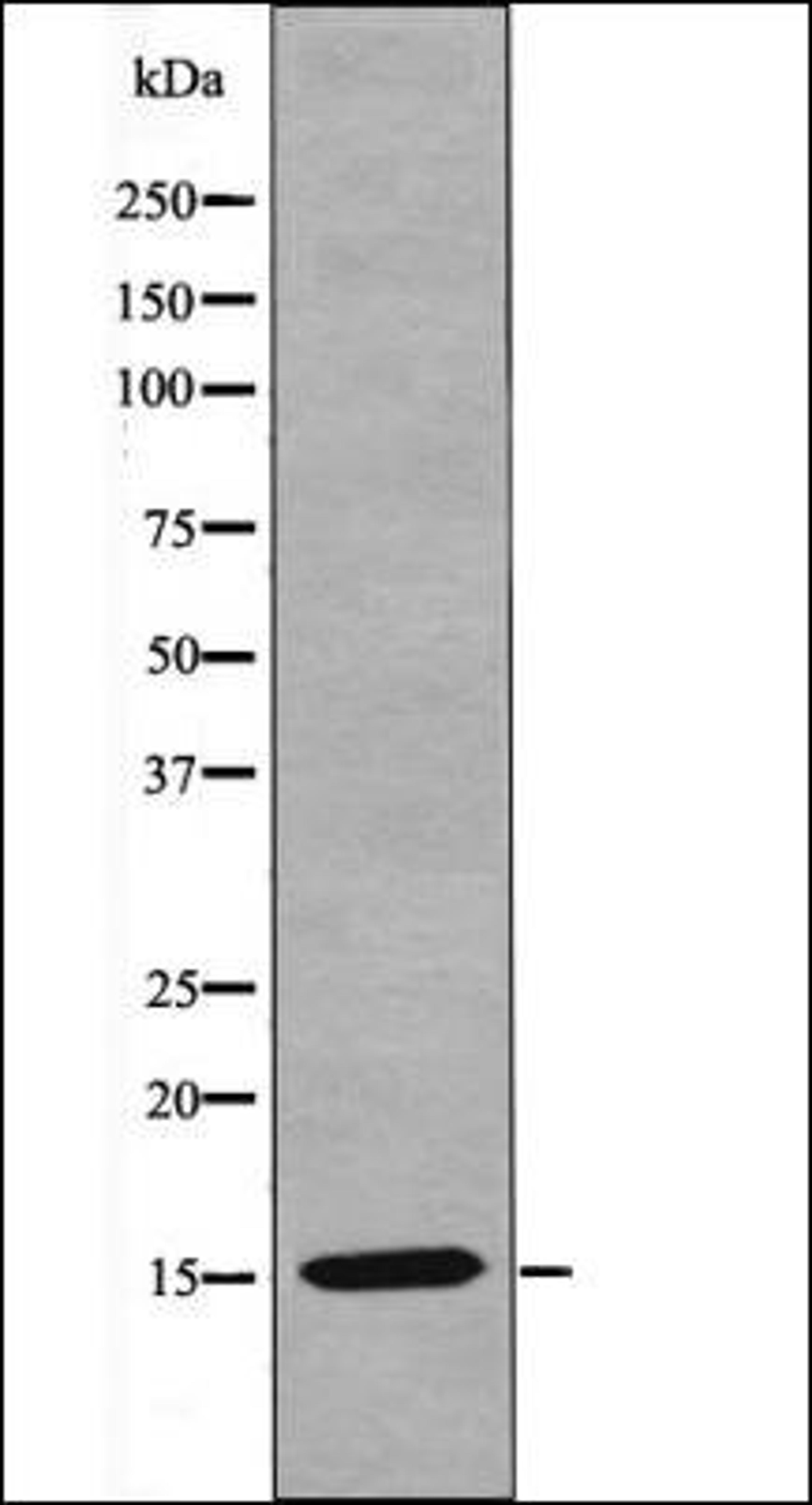 Western blot analysis of HeLa whole cell lysates using VAMP4 -Phospho-Ser30- antibody