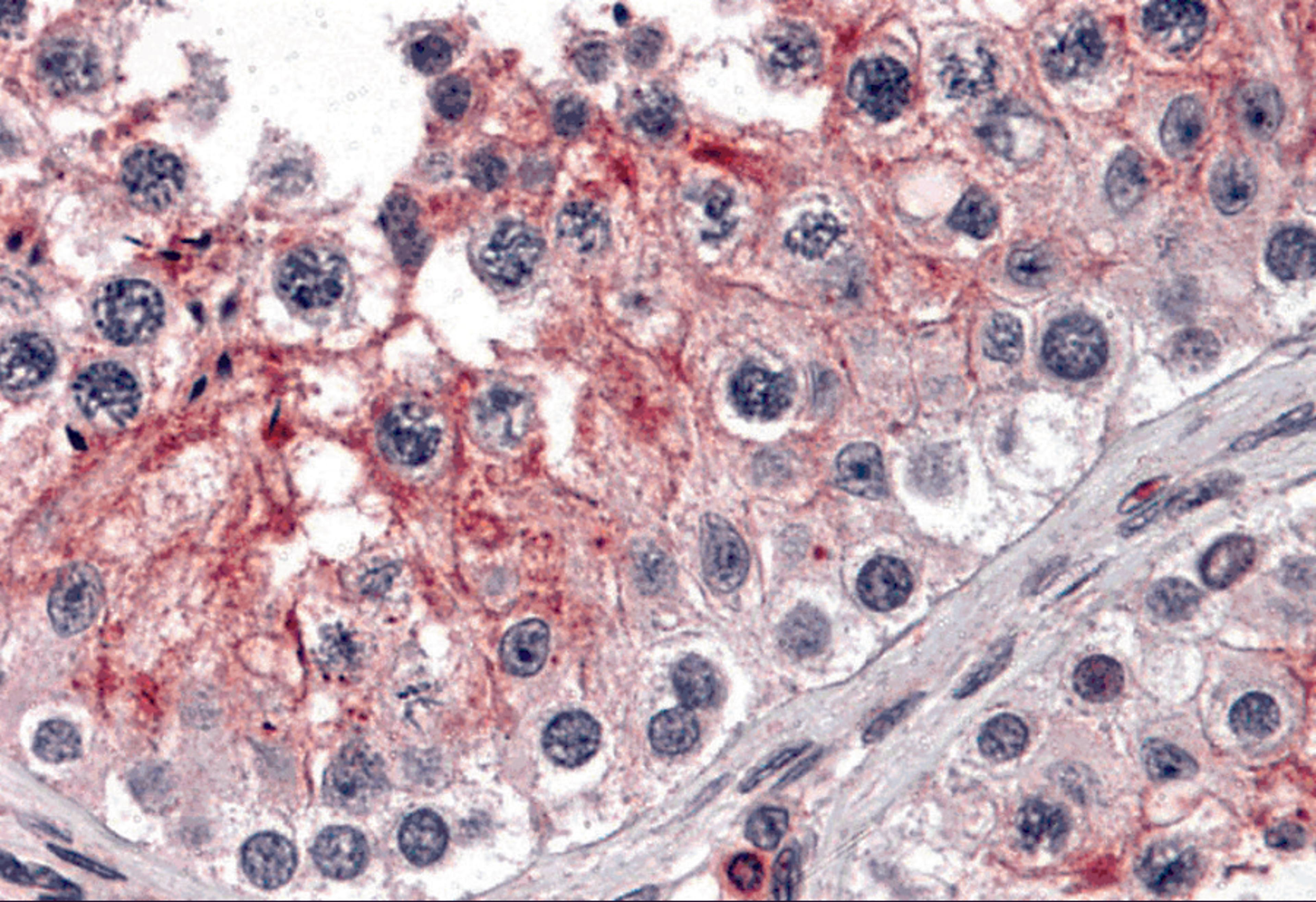 Immunohistochemistry of KPNA5 in human testis tissue with KPNA5 antibody at 5 μg/mL.