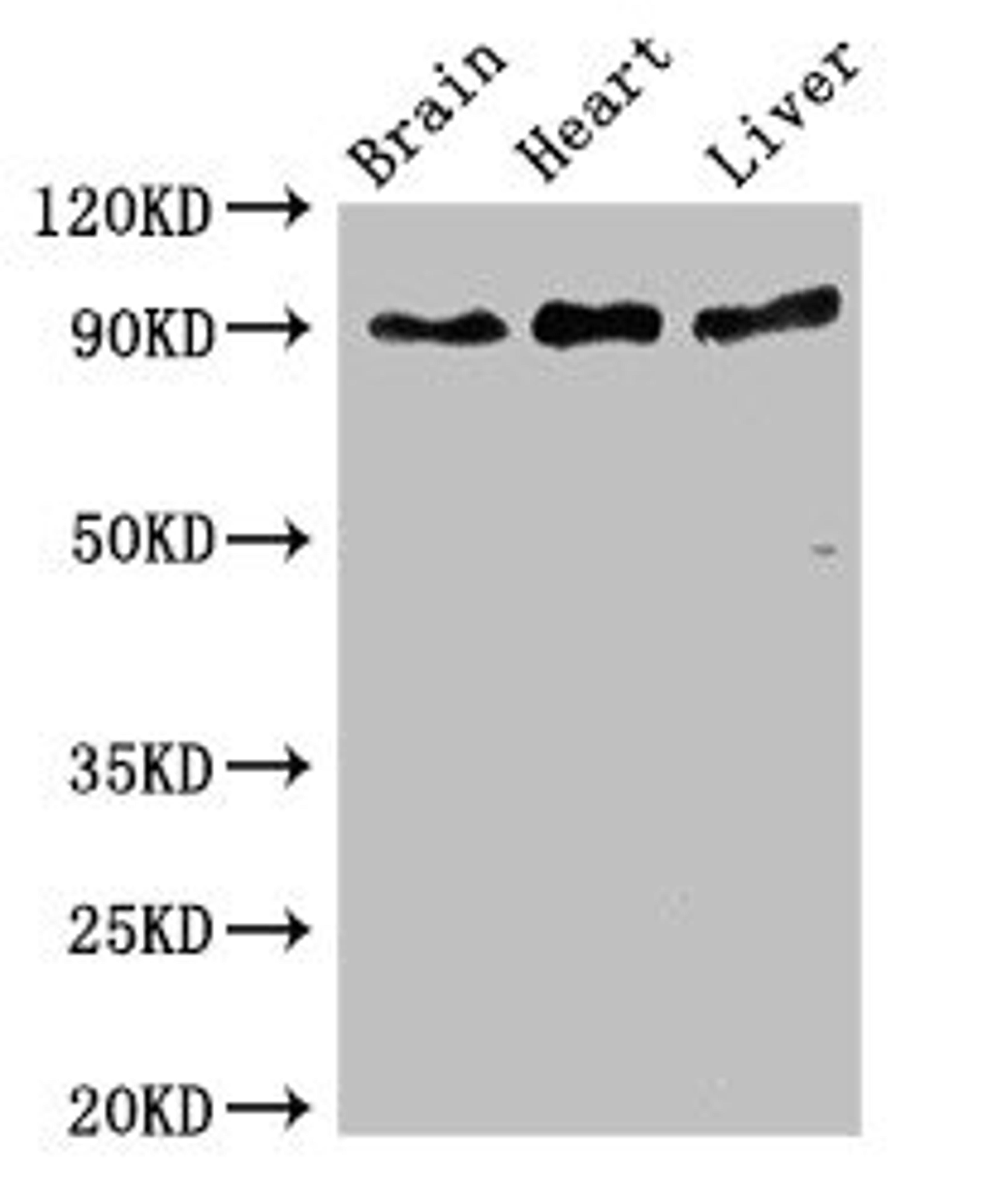 Western Blot. Positive WB detected in: Mouse brain tissue, Rat heart tissue, Rat liver tissue. All lanes: RPS6KA5 antibody at 3ug/ml. Secondary. Goat polyclonal to rabbit IgG at 1/50000 dilution. Predicted band size: 90, 62, 82 kDa. Observed band size: 90 kDa. 
