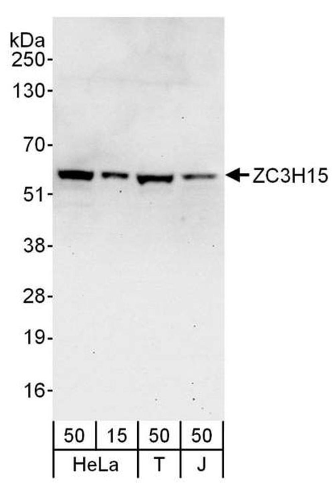 Detection of human ZC3H15 by WB.