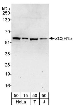 Detection of human ZC3H15 by WB.