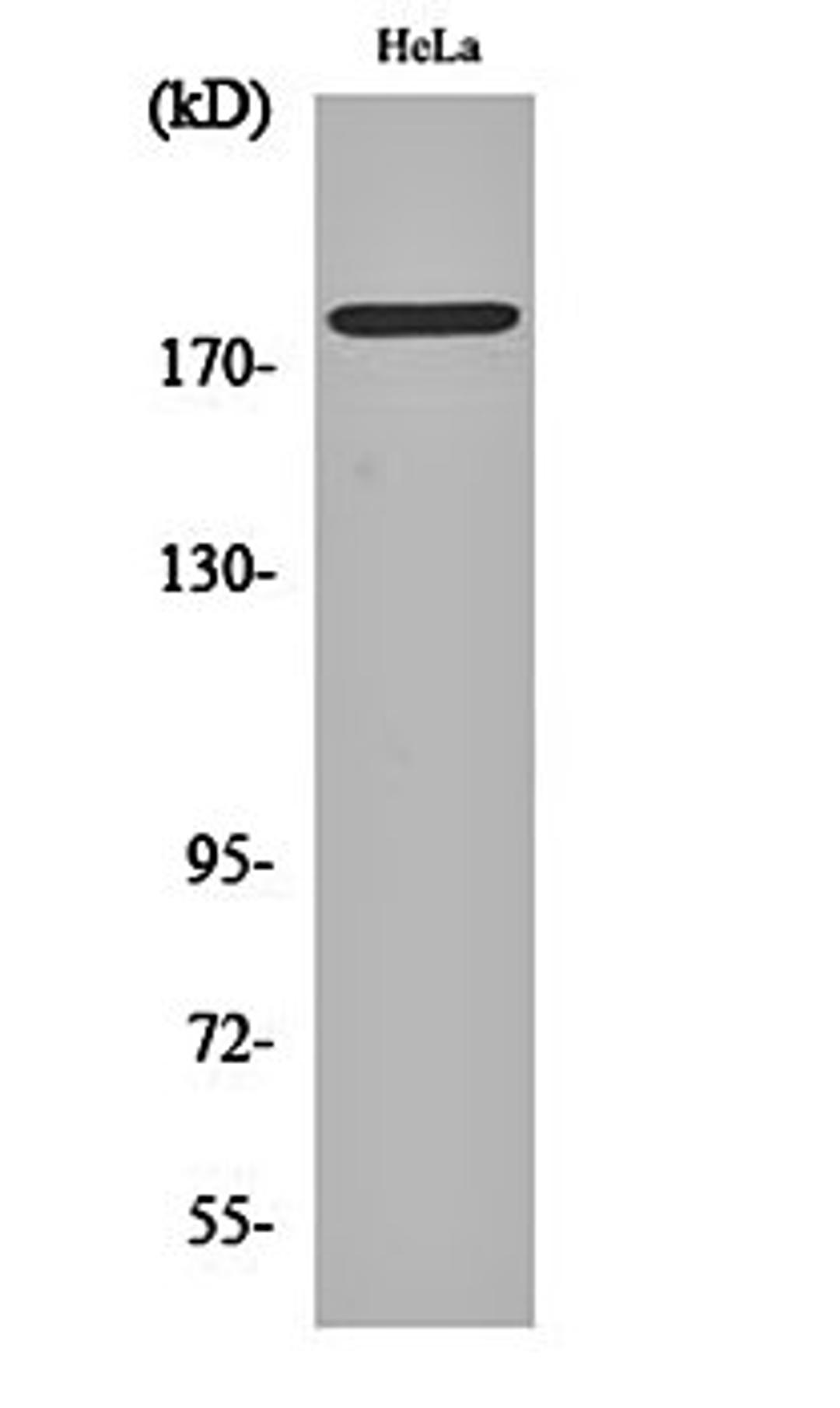 Western blot analysis of Hela cell lysates using Neu (phospho-Y877) antibody