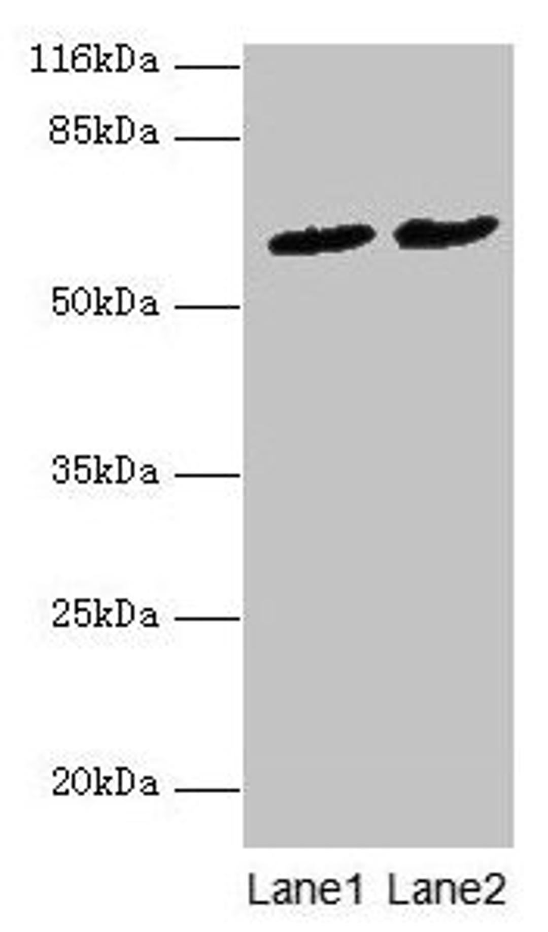 Western blot. All lanes: PDZD3 antibody at 2µg/ml. Lane 1: Mouse kidney tissue. Lane 2: Mouse heart tissue. Secondary. Goat polyclonal to rabbit IgG at 1/10000 dilution. Predicted band size: 62, 55, 53, 42, 25 kDa. Observed band size: 62 kDa