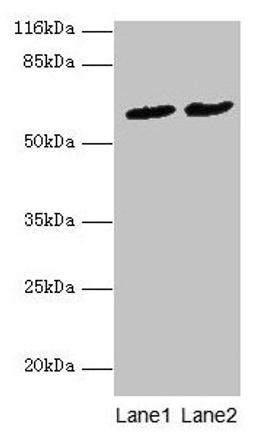 Western blot. All lanes: PDZD3 antibody at 2µg/ml. Lane 1: Mouse kidney tissue. Lane 2: Mouse heart tissue. Secondary. Goat polyclonal to rabbit IgG at 1/10000 dilution. Predicted band size: 62, 55, 53, 42, 25 kDa. Observed band size: 62 kDa