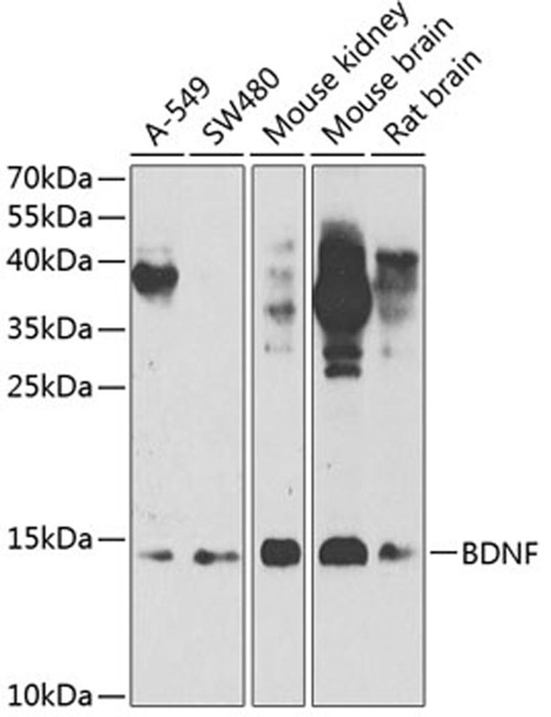 Western blot - BDNF antibody (A1307)