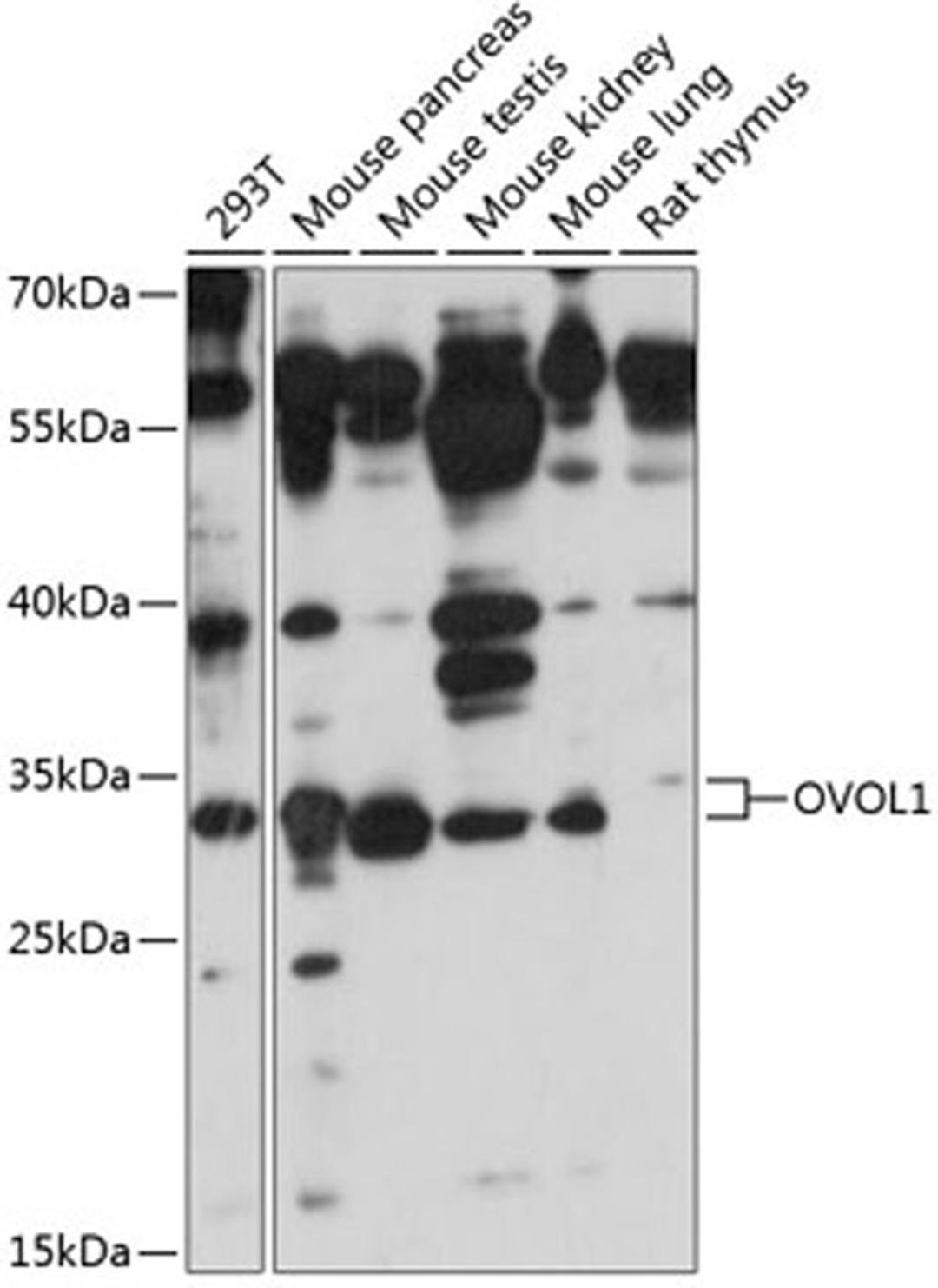 Western blot - OVOL1 antibody (A14379)