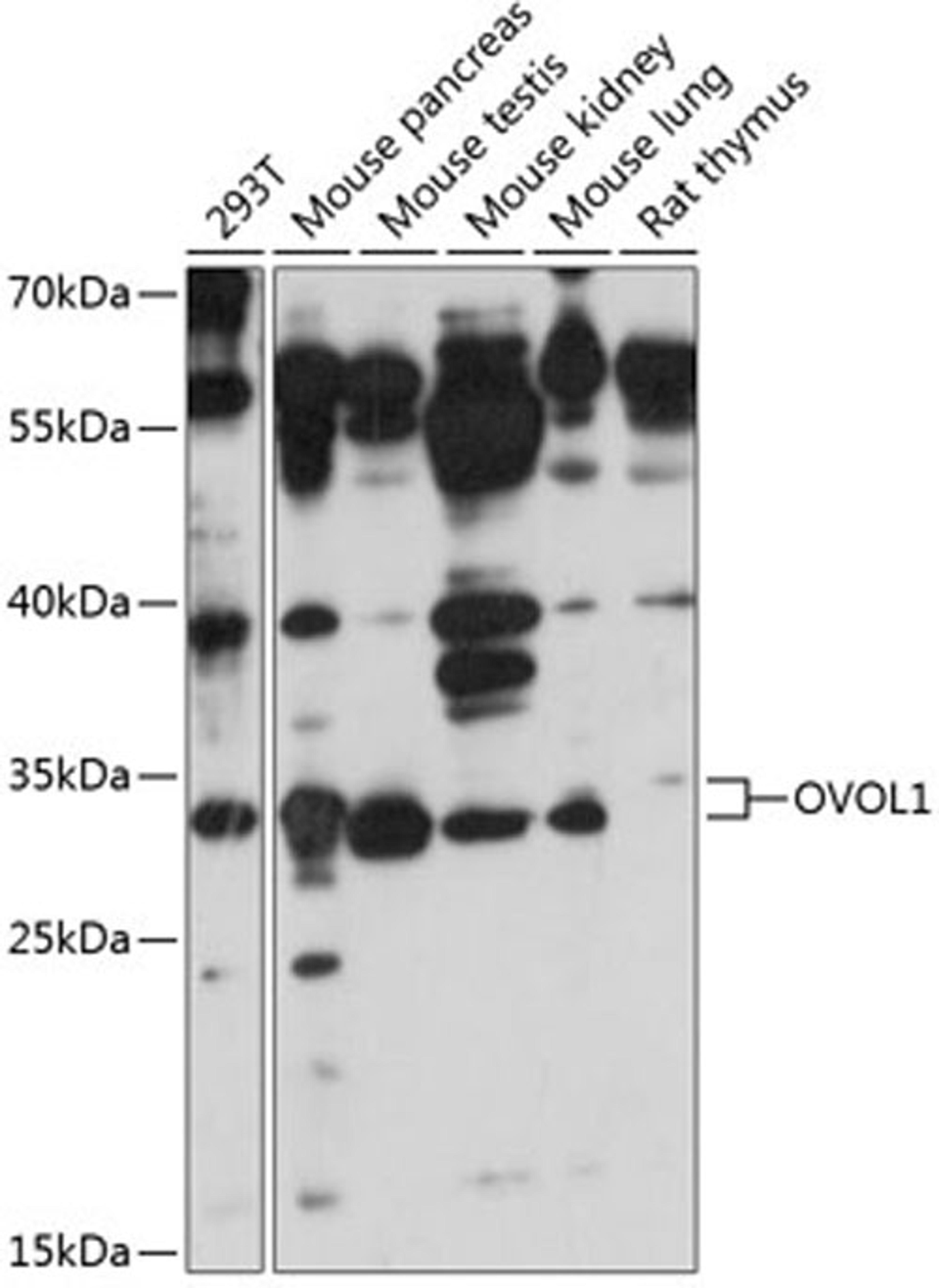 Western blot - OVOL1 antibody (A14379)