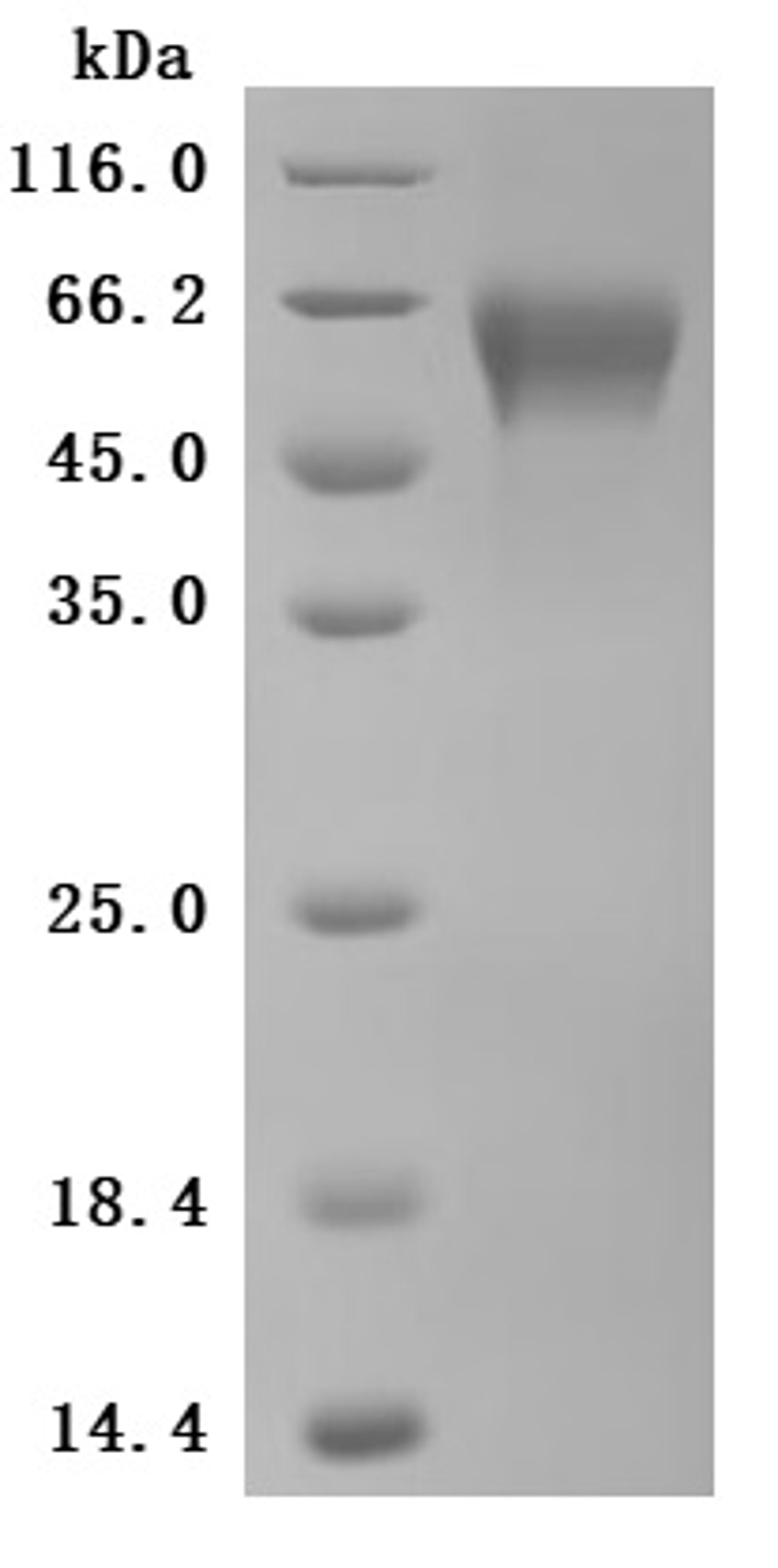 (Tris-Glycine gel) Discontinuous SDS-PAGE (reduced) with 5% enrichment gel and 15% separation gel.