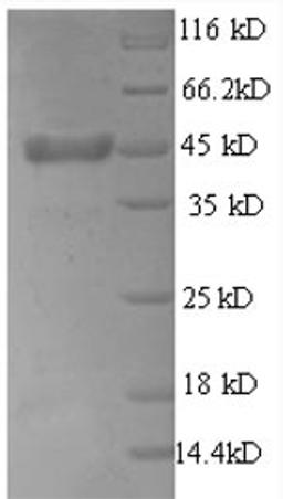 (Tris-Glycine gel) Discontinuous SDS-PAGE (reduced) with 5% enrichment gel and 15% separation gel.