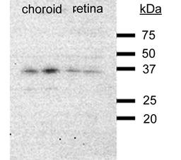 Western blot analysis of chicken choroid and retinal tissues using VEGF antibody [Reviews]