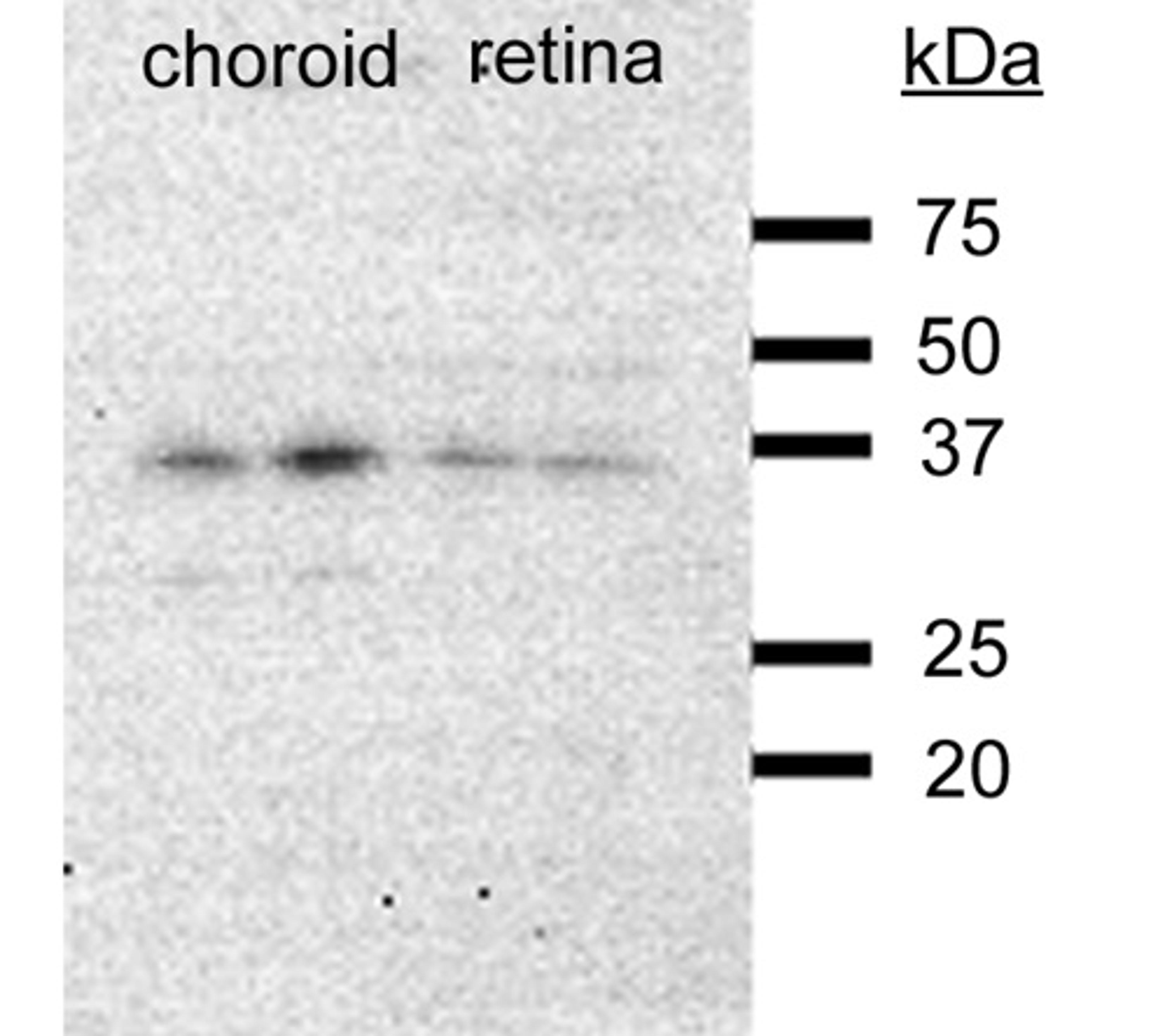 Western blot analysis of chicken choroid and retinal tissues using VEGF antibody [Reviews]