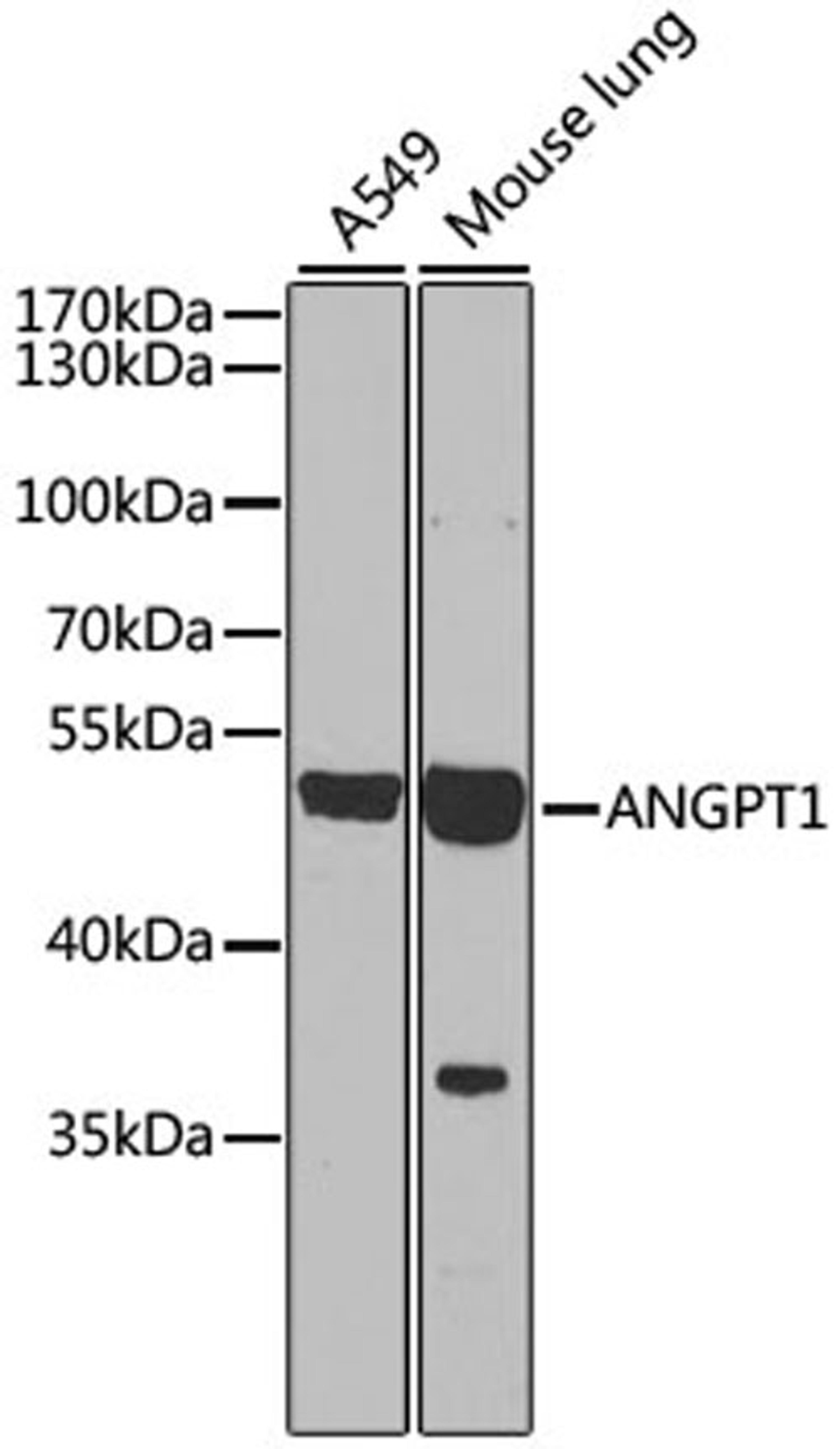 Western blot - ANGPT1 antibody (A7877)