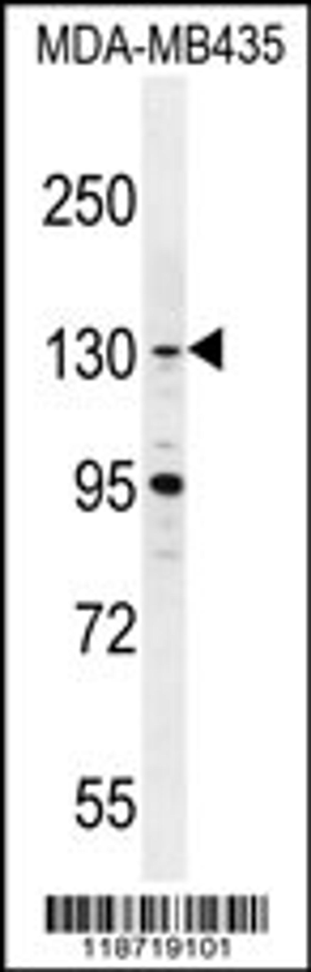 Western blot analysis in MDA-MB435 cell line lysates (35ug/lane).